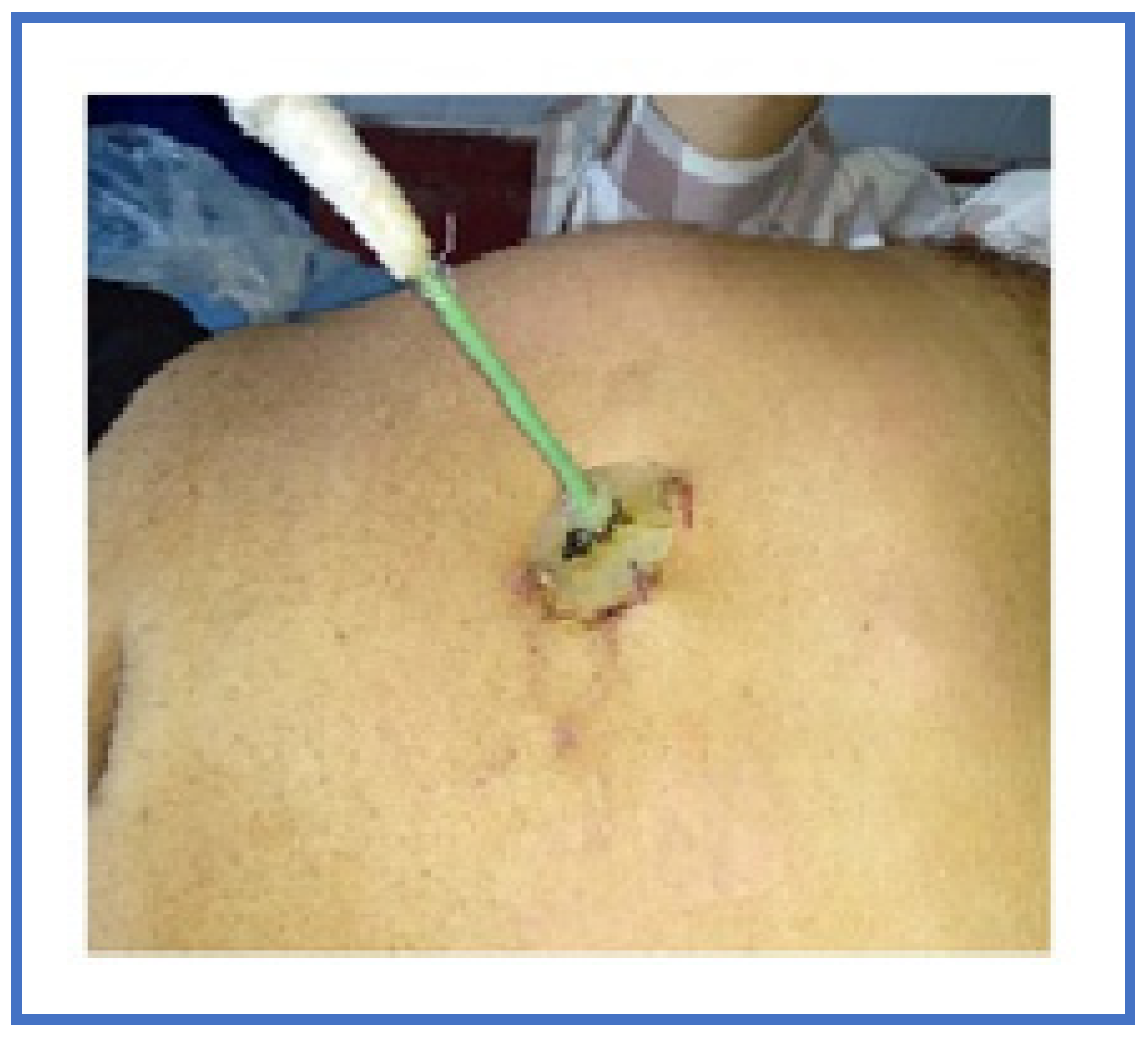 Pathogens 12 00428 g003