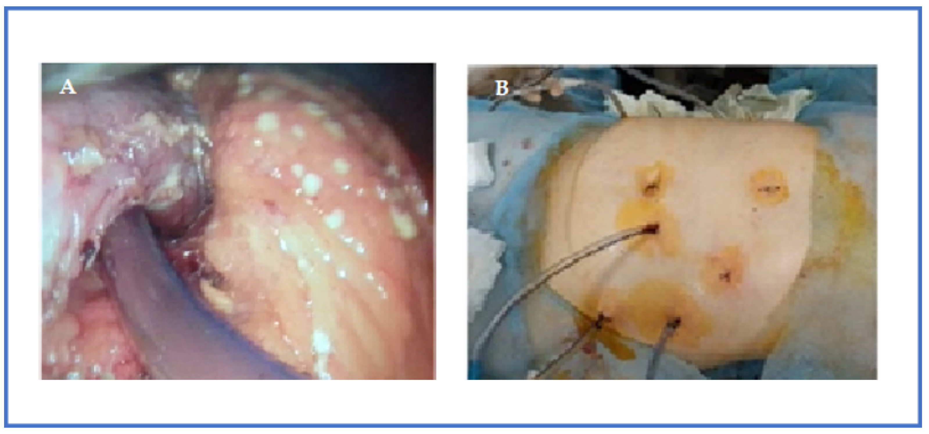 Pathogens 12 00428 g004