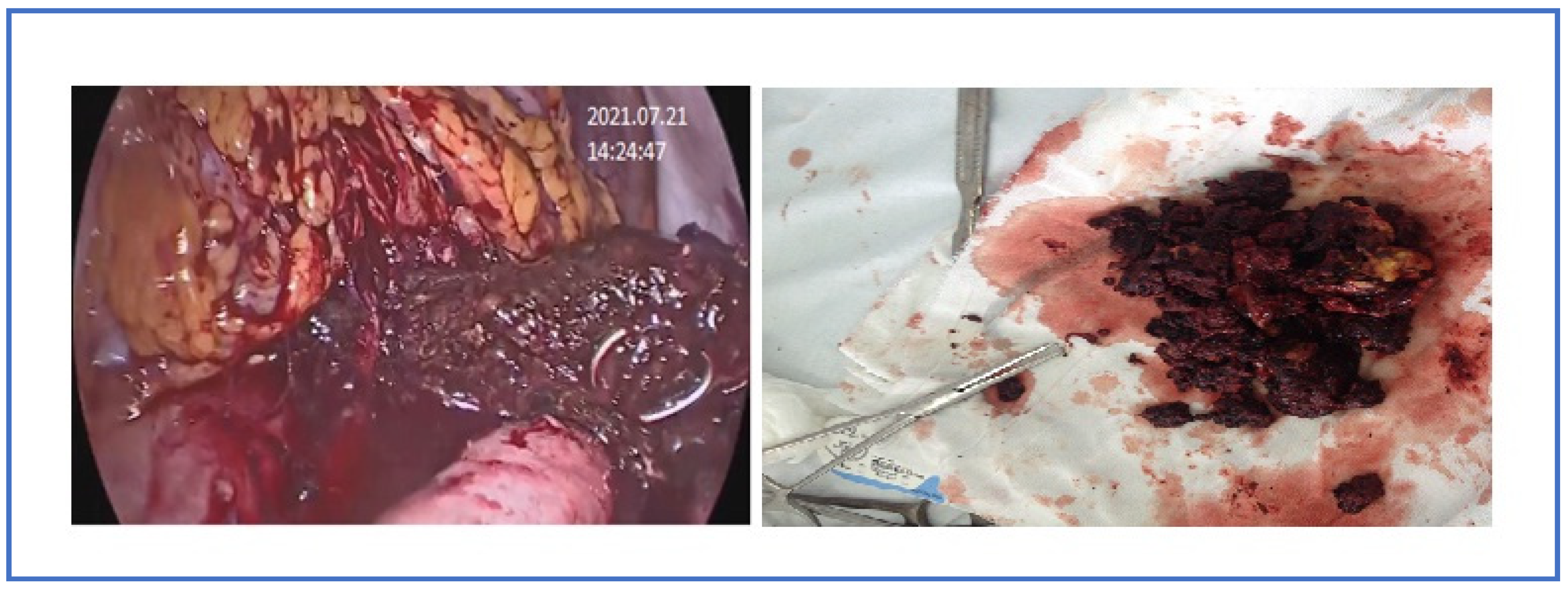 Pathogens 12 00428 g005