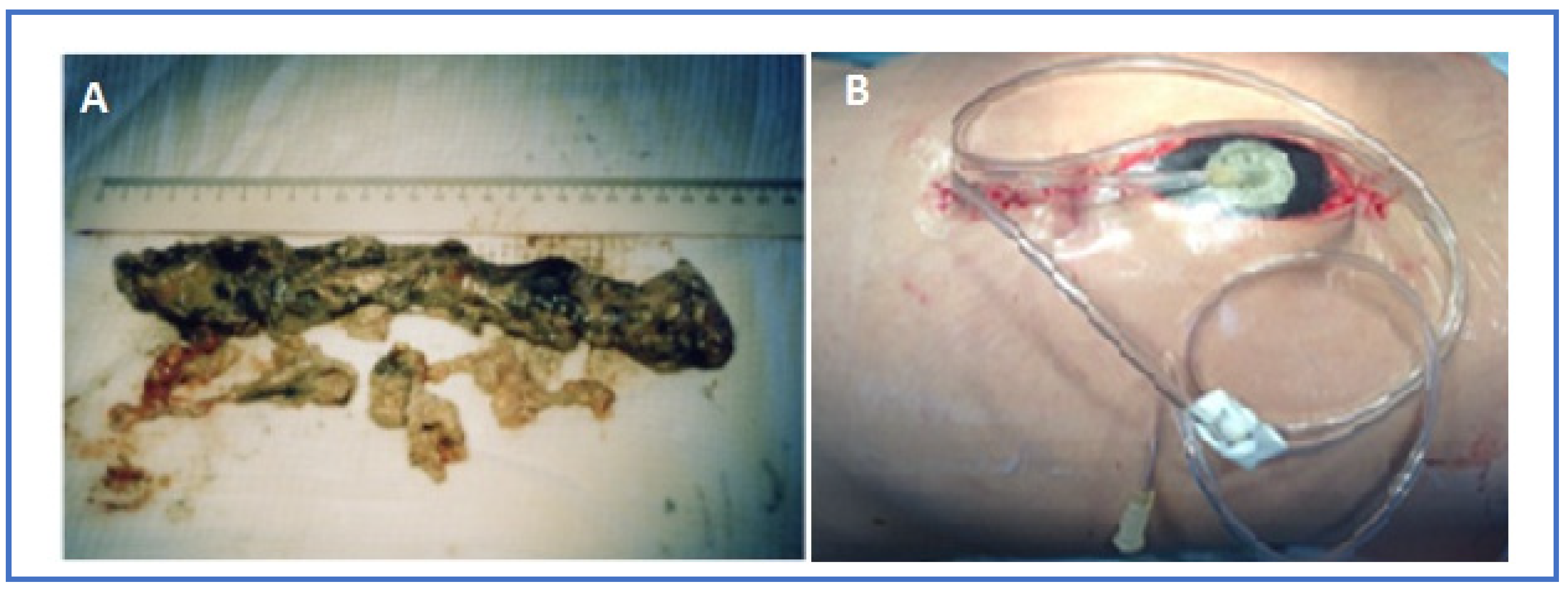 Pathogens 12 00428 g006