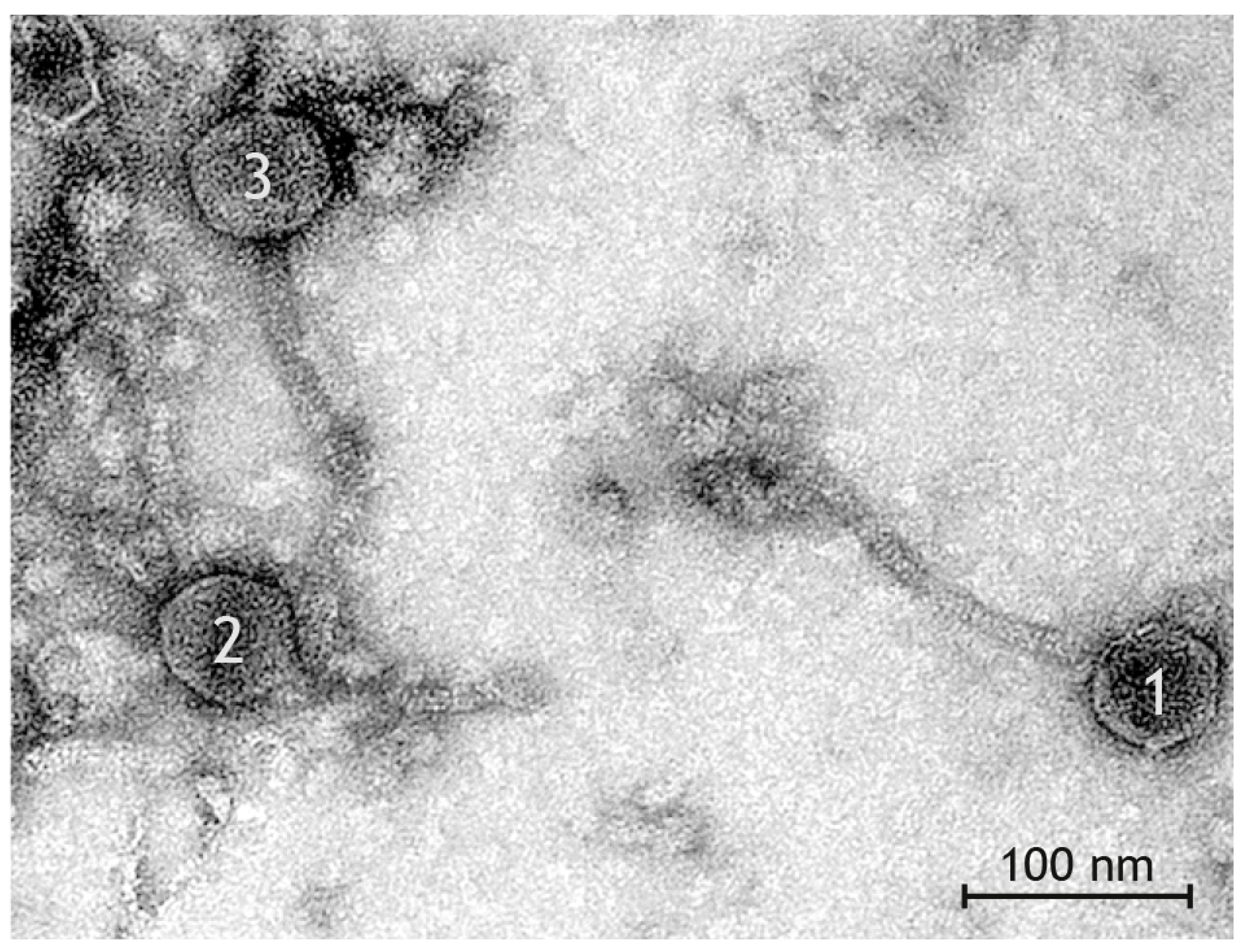Pathogens 12 00704 g002
