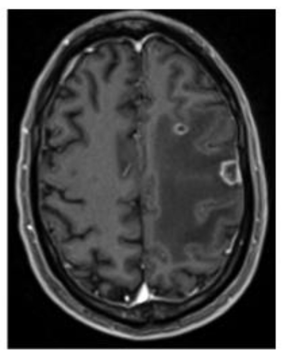 Pathogens 12 00772 g001 Pathogens 12 00772 g001