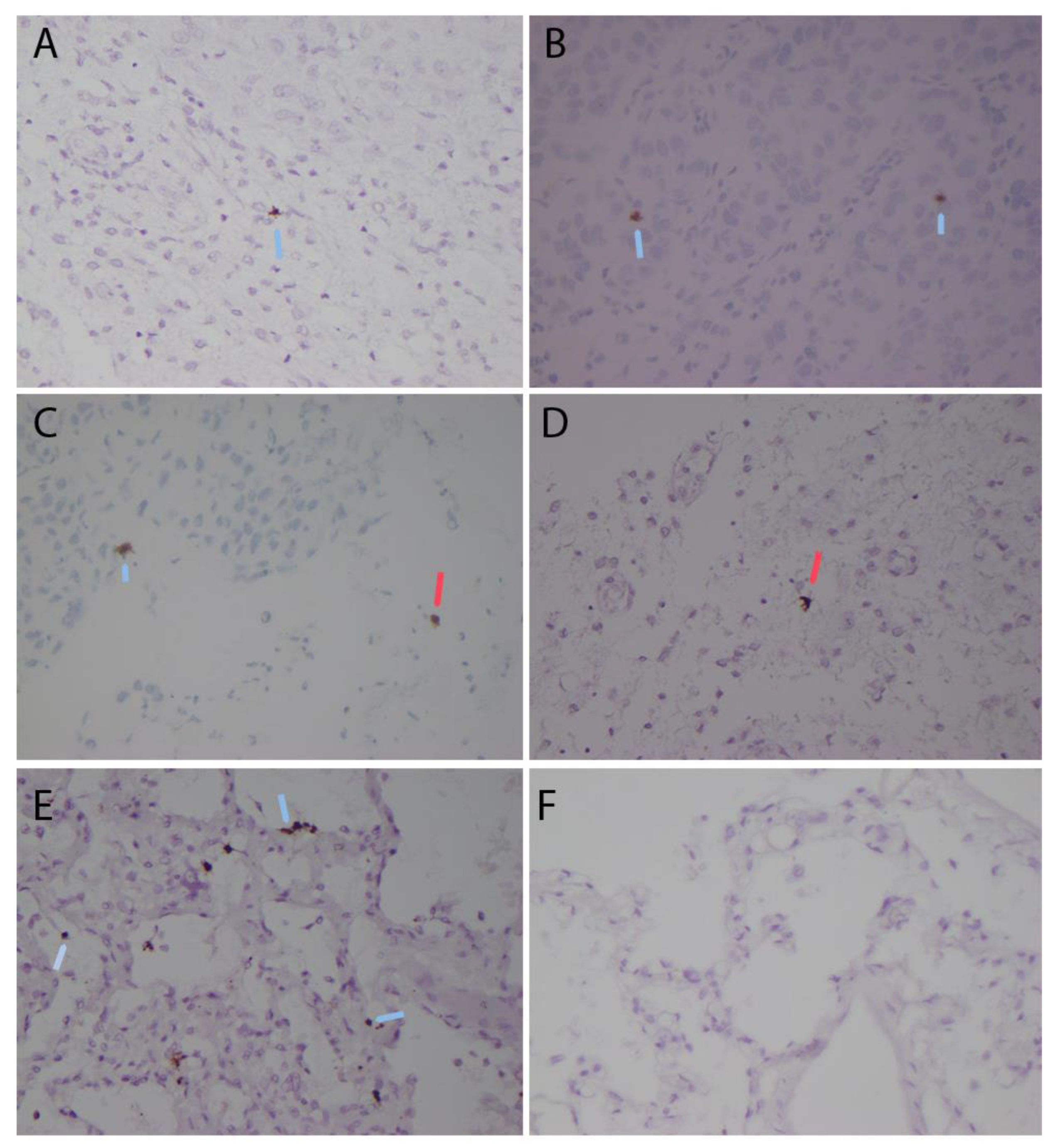 Pathogens 12 00772 g003 Pathogens 12 00772 g003