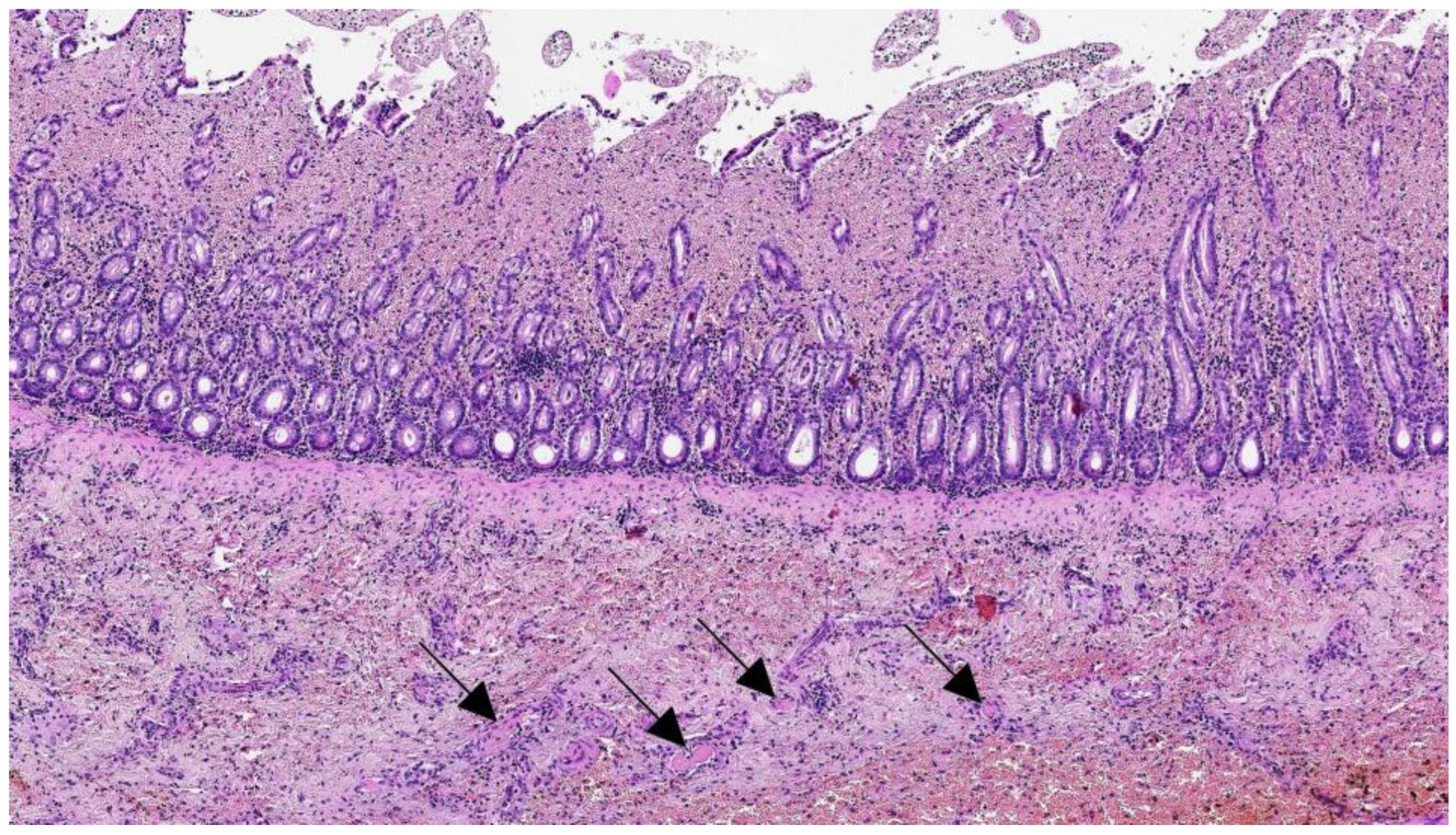 Pathogens 12 00822 g005