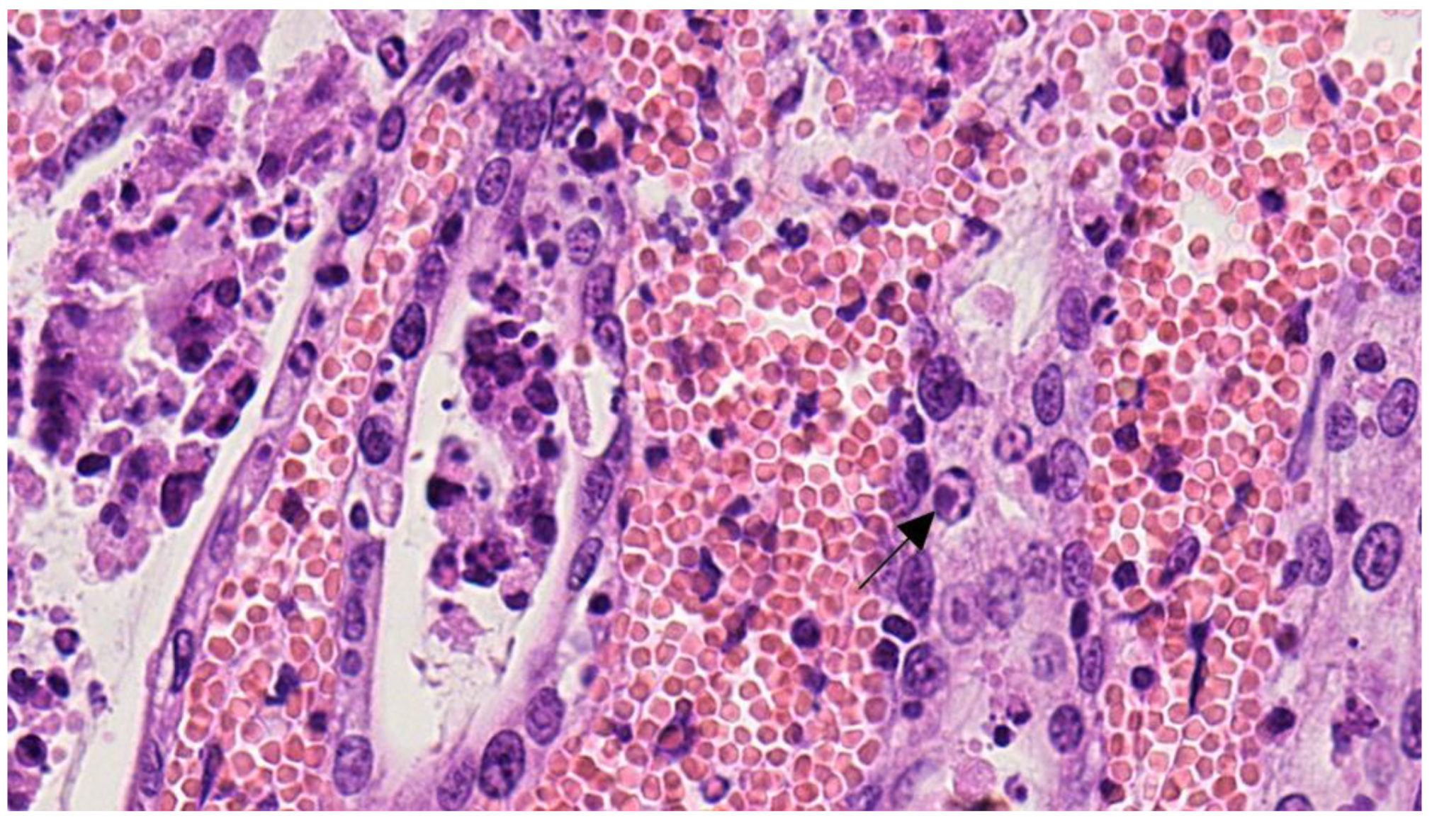 Pathogens 12 00822 g006