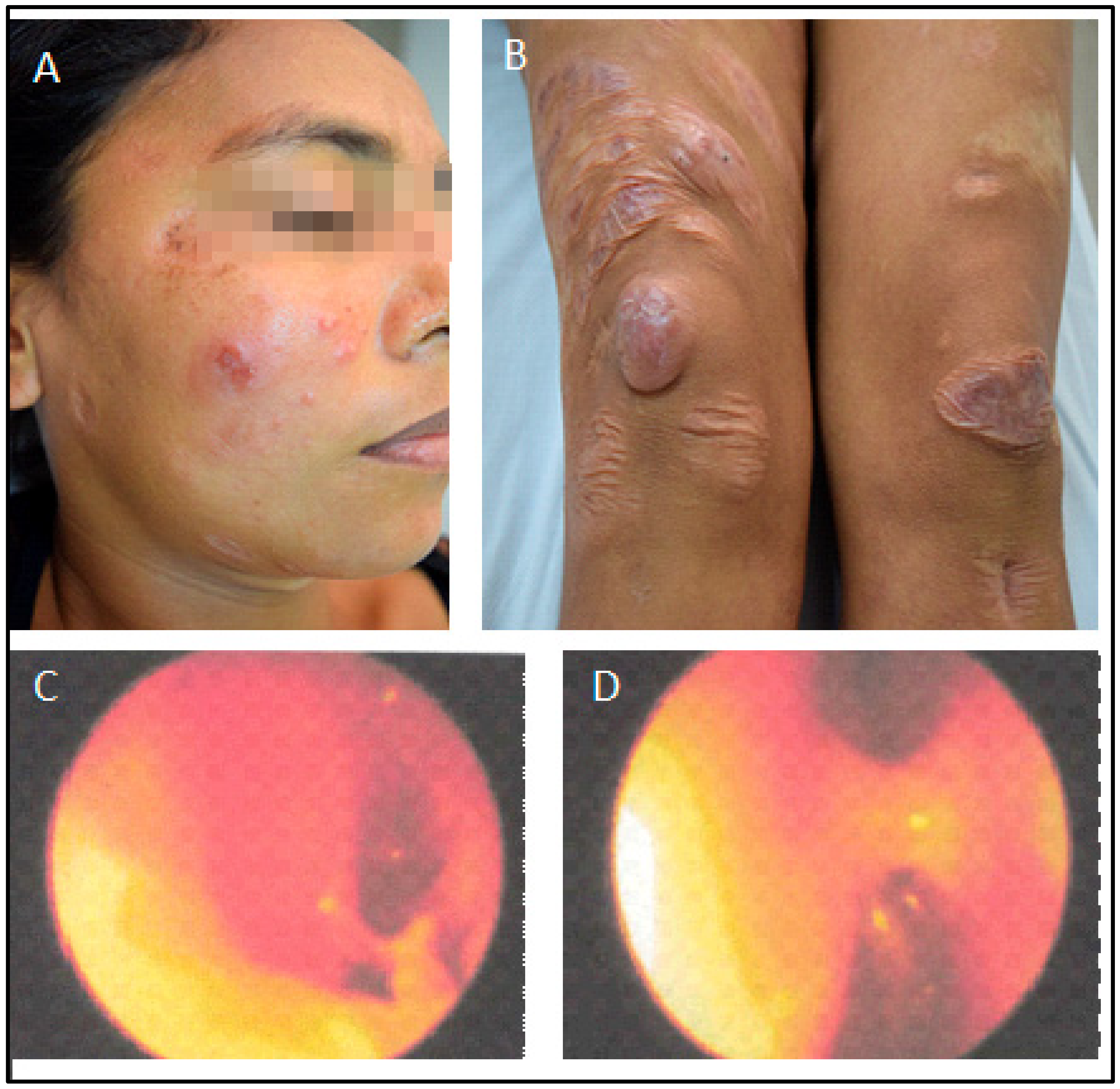 Pathogens 12 00890 g004