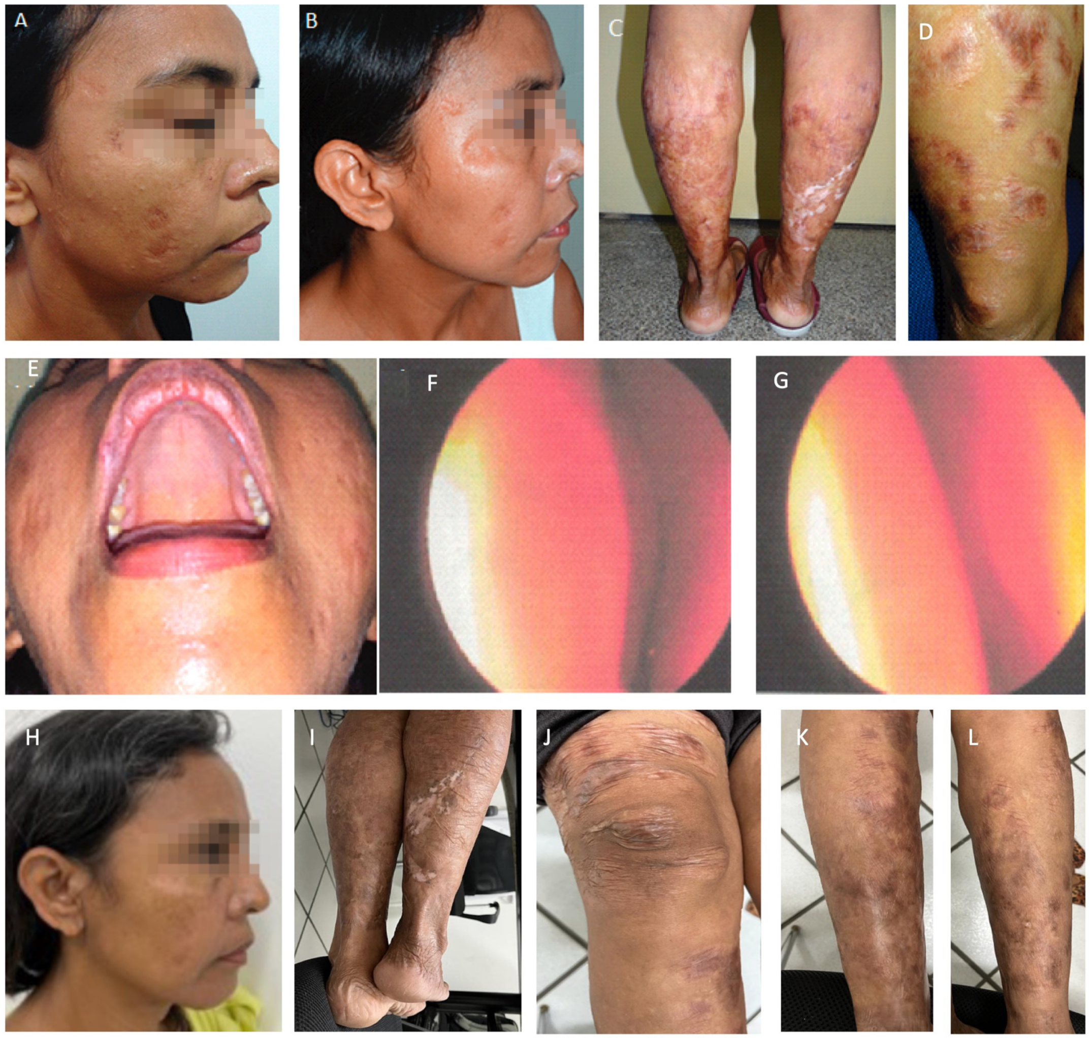 Pathogens 12 00890 g005