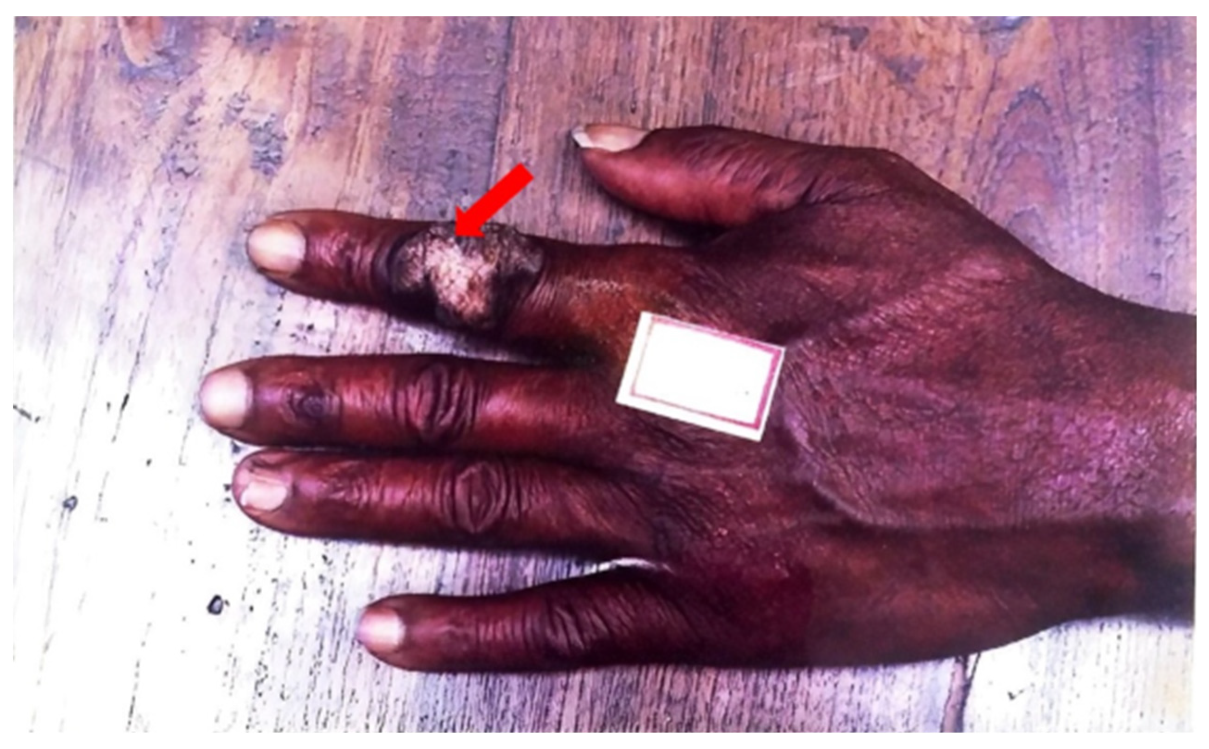 Pathogens 12 00920 g003