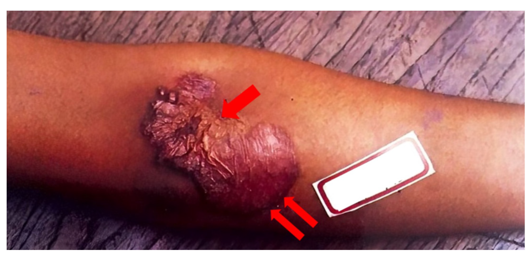 Pathogens 12 00920 g005