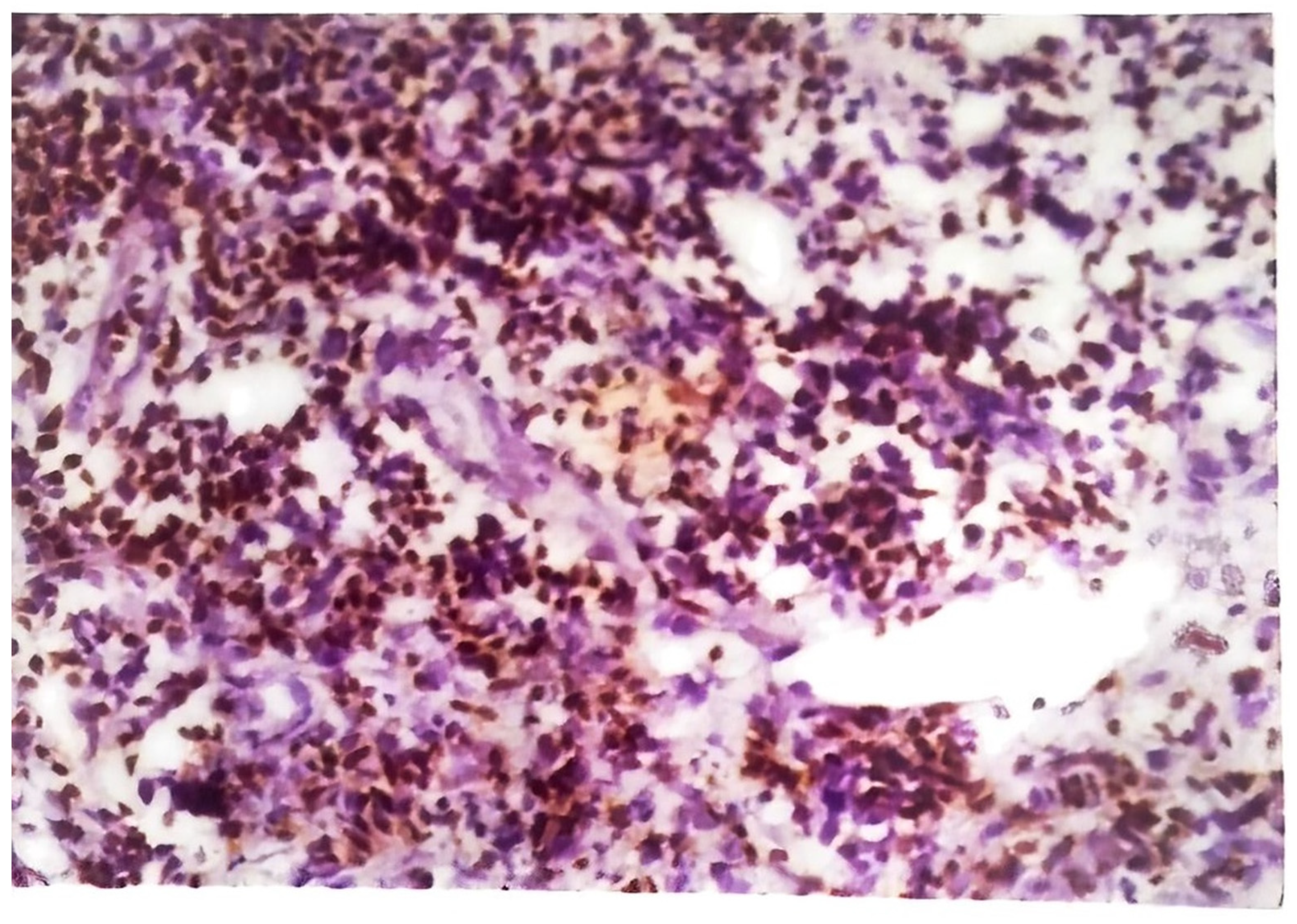 Pathogens 12 00920 g006