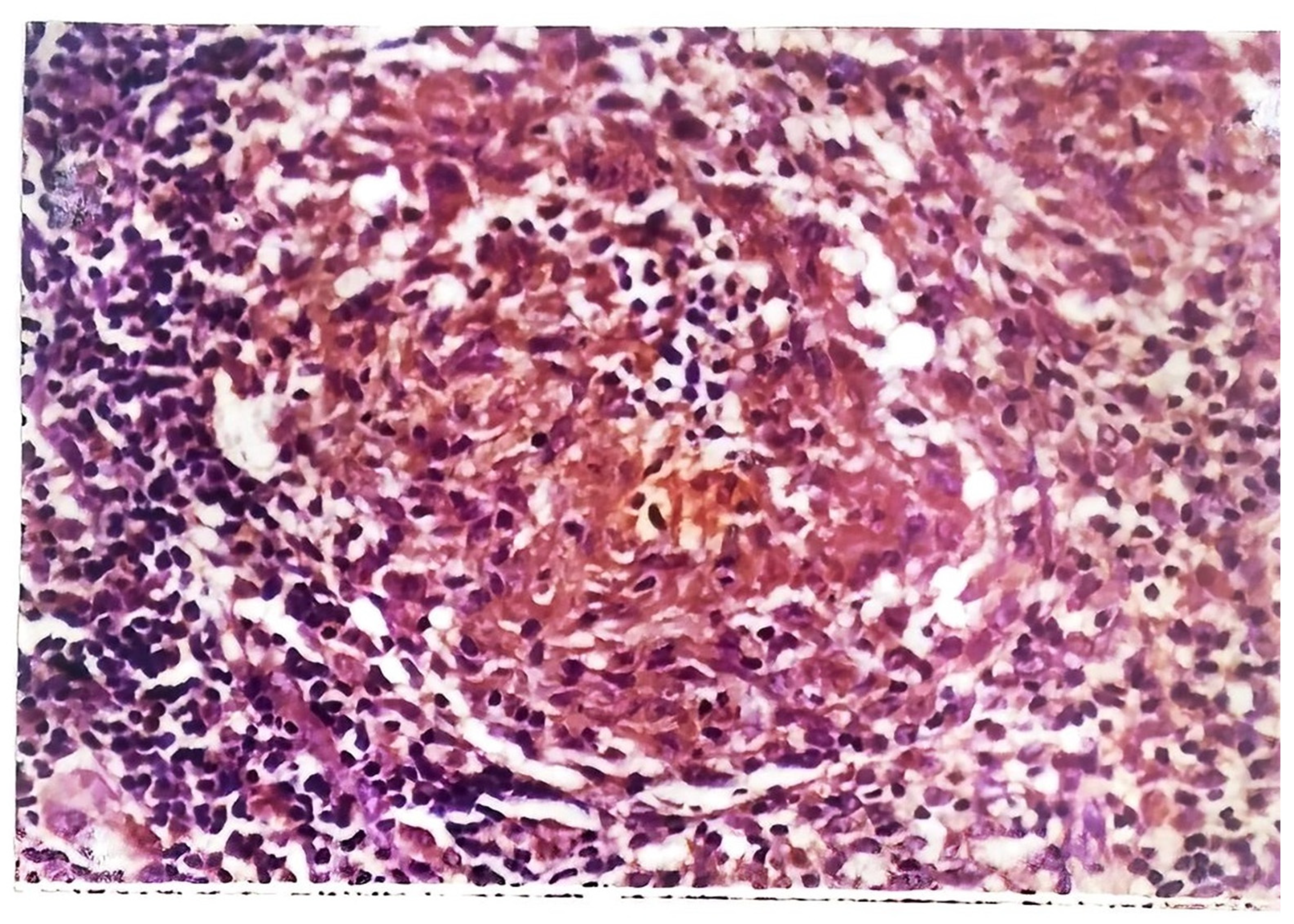 Pathogens 12 00920 g008