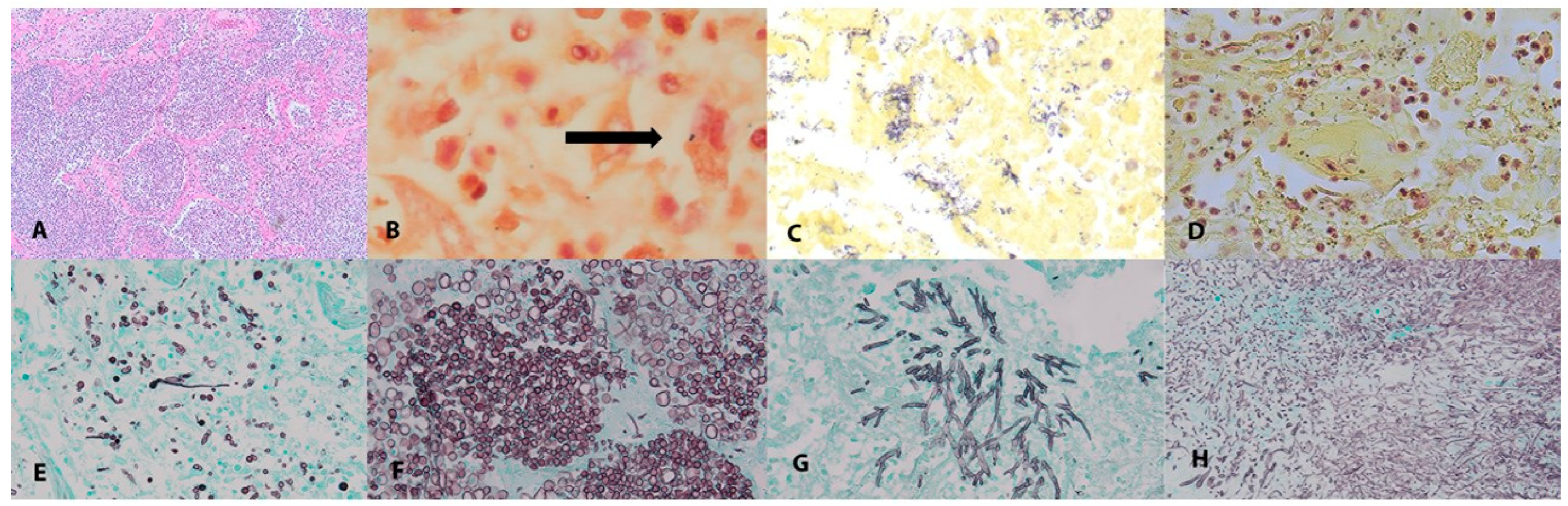 Pathogens 12 00932 g001 Pathogens 12 00932 g001