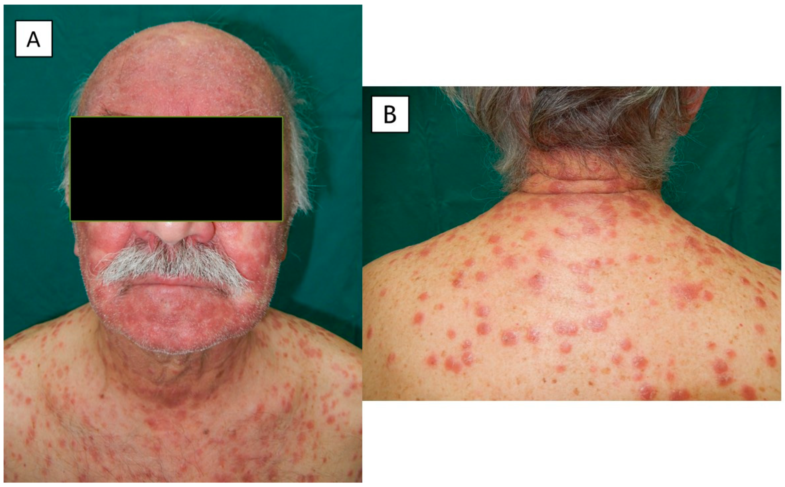 Pathogens 12 01054 g002