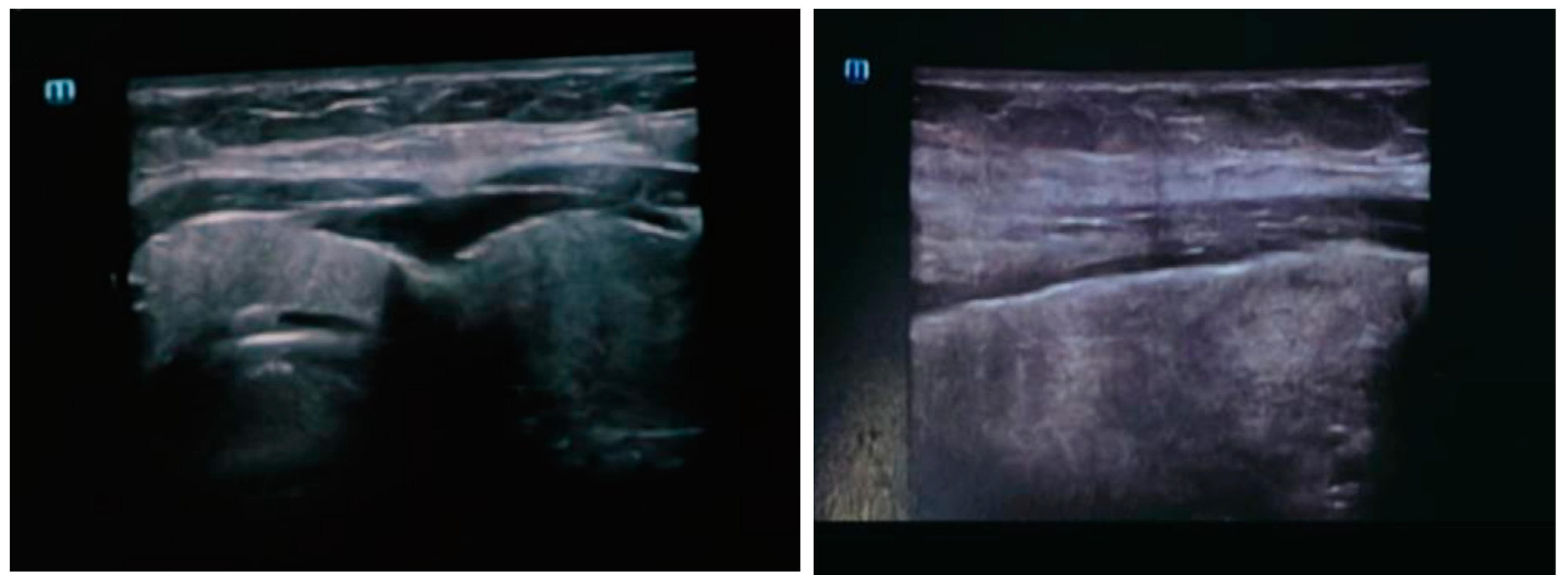 Pathogens 12 01309 g001