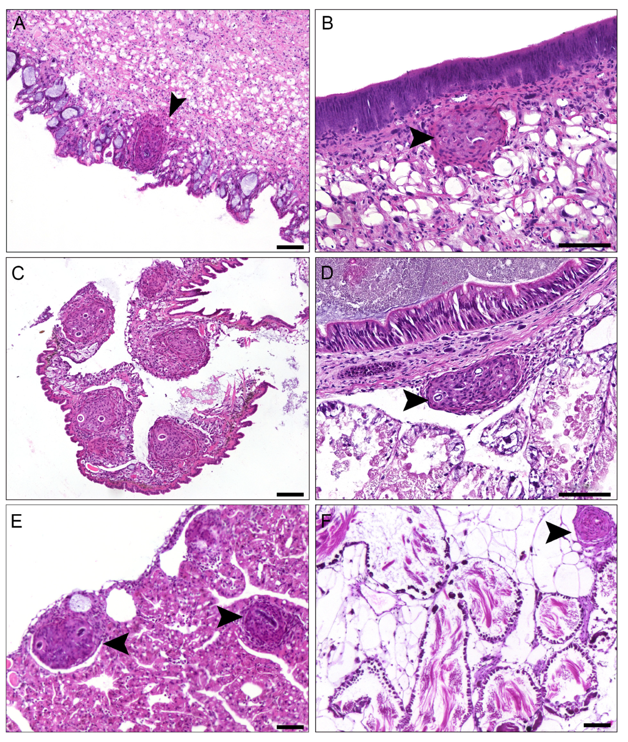 A Structural Analysis of Host–Parasite Interactions in Achatina  fulica (Giant African Snail) Infected with Angiostrongylus cantonensis