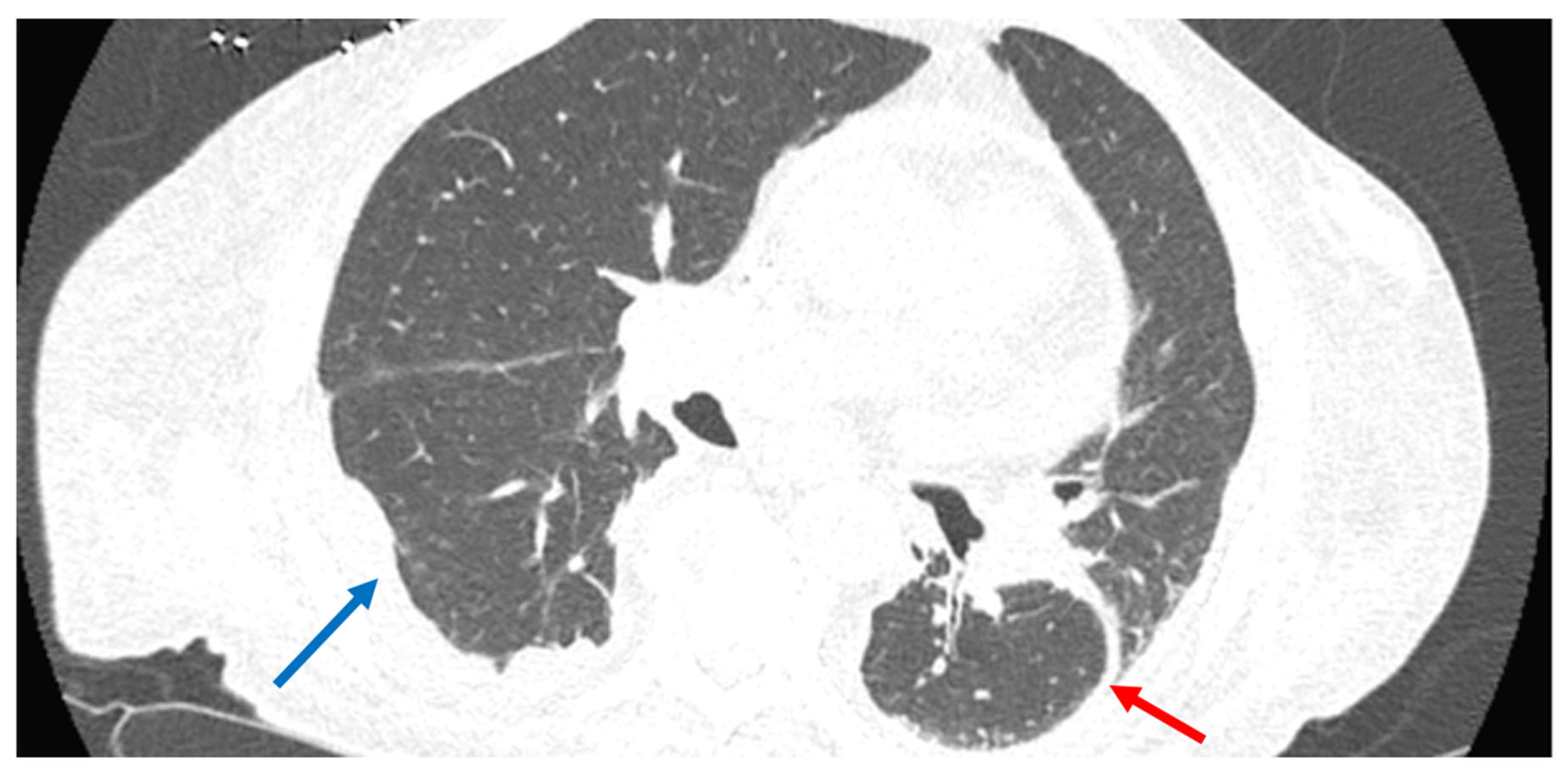 Pathogens 13 00165 g001