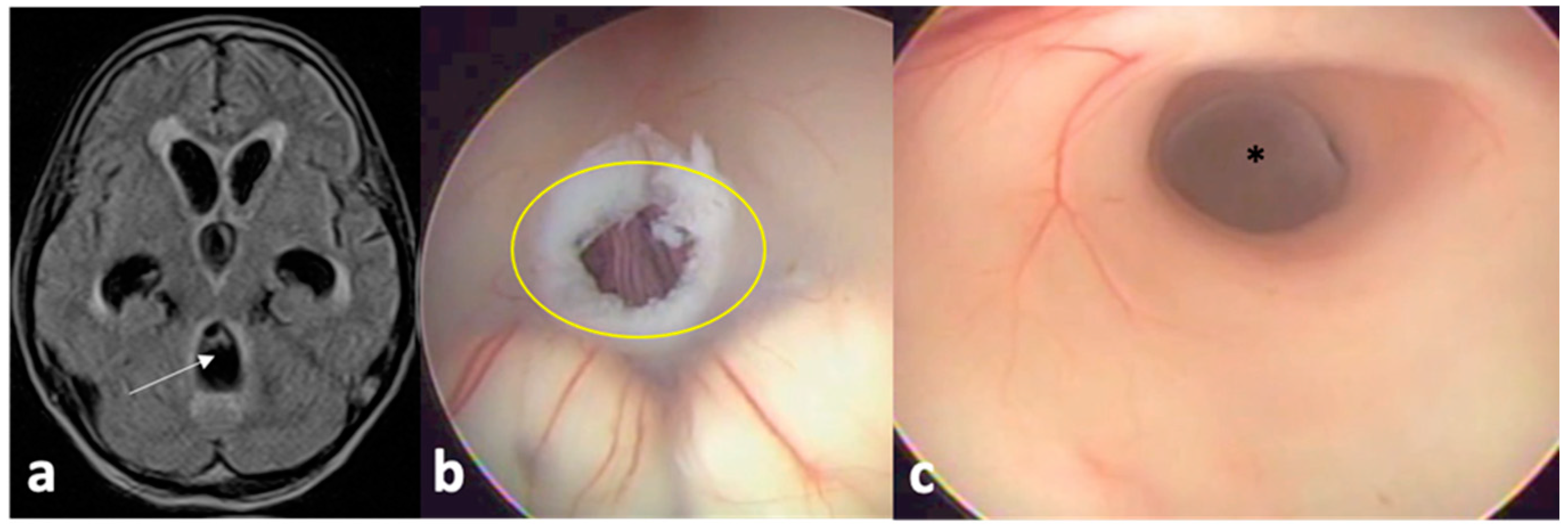 Pathogens 13 00218 g002