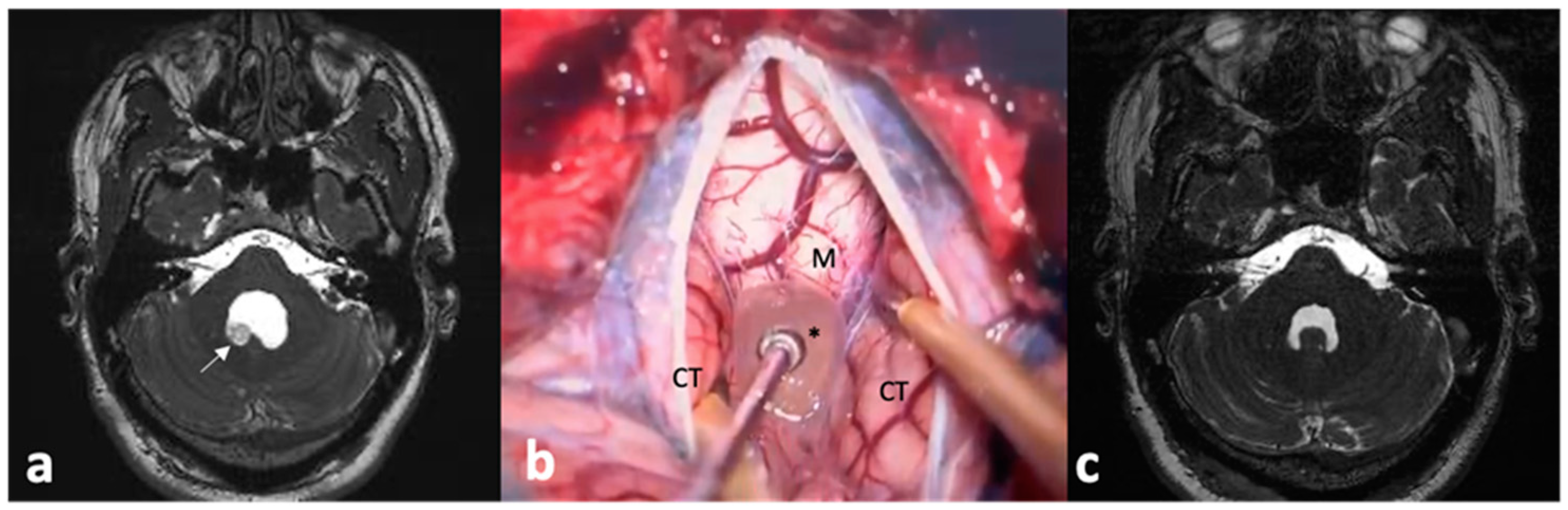 Pathogens 13 00218 g004