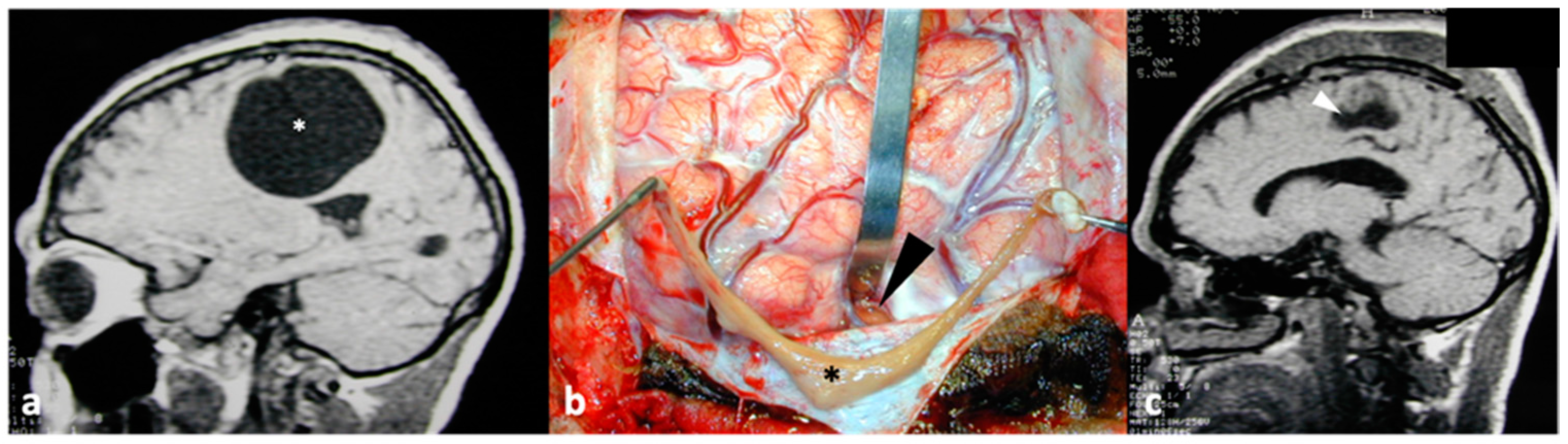 Pathogens 13 00218 g006
