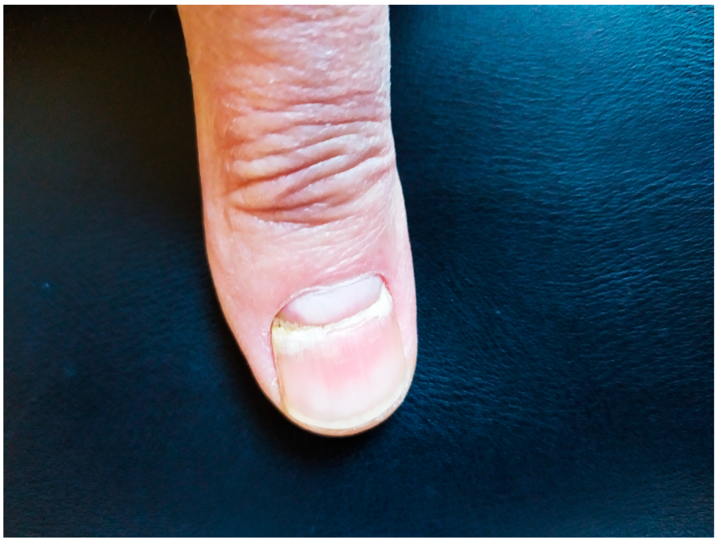 Pathogens 13 00265 g001