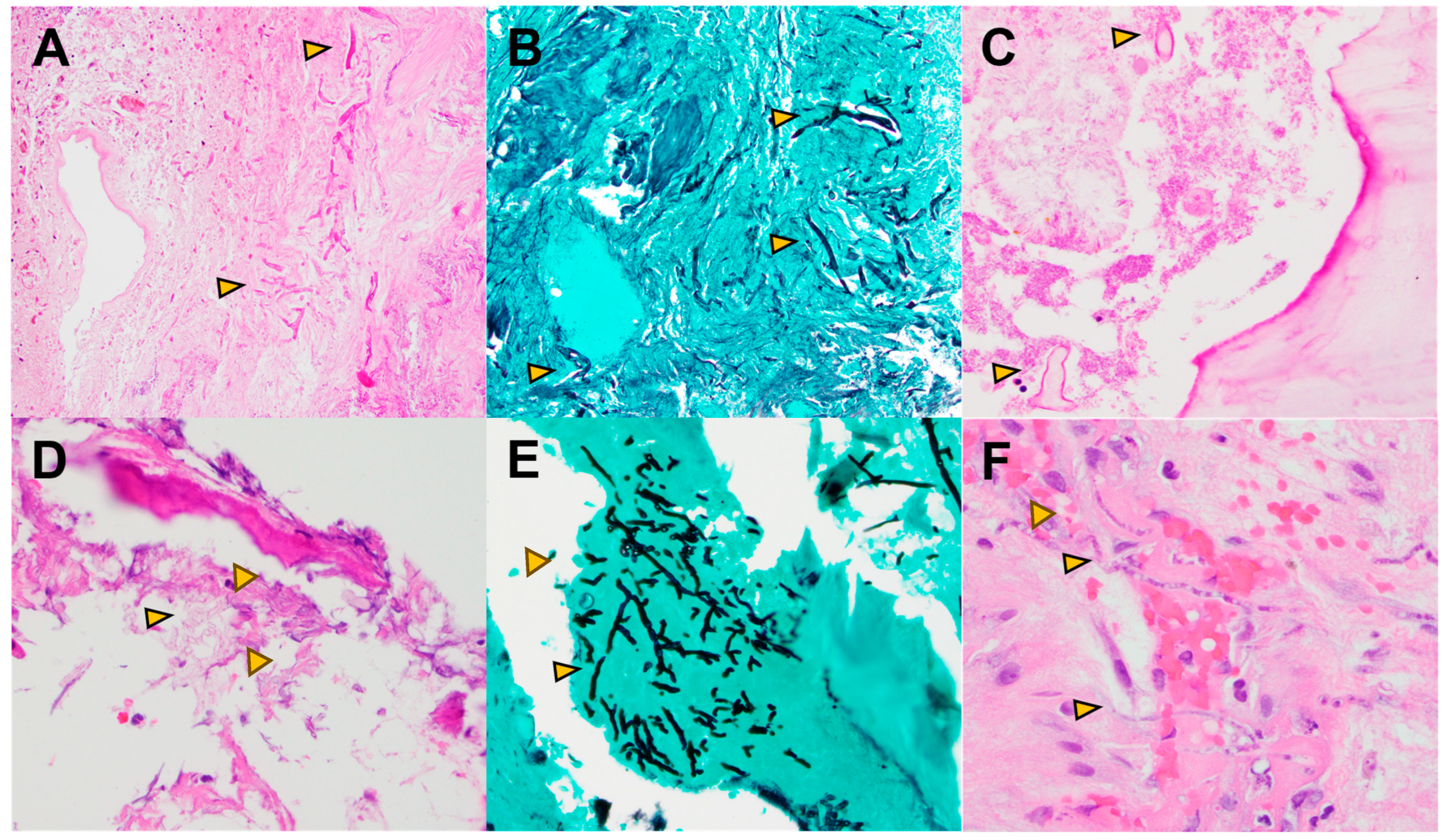 Pathogens 13 00530 g001 Pathogens 13 00530 g001