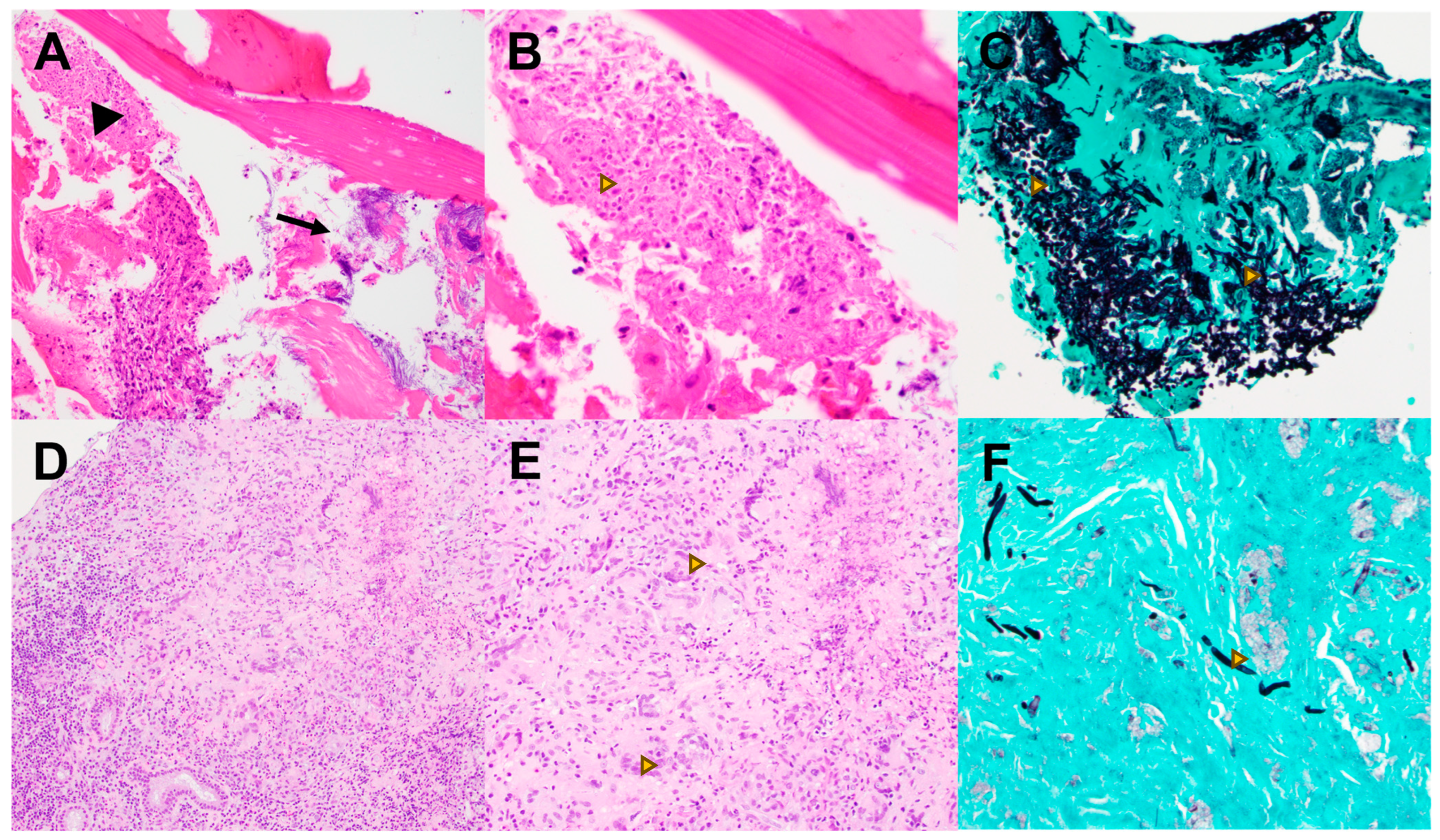 Pathogens 13 00530 g003 Pathogens 13 00530 g003