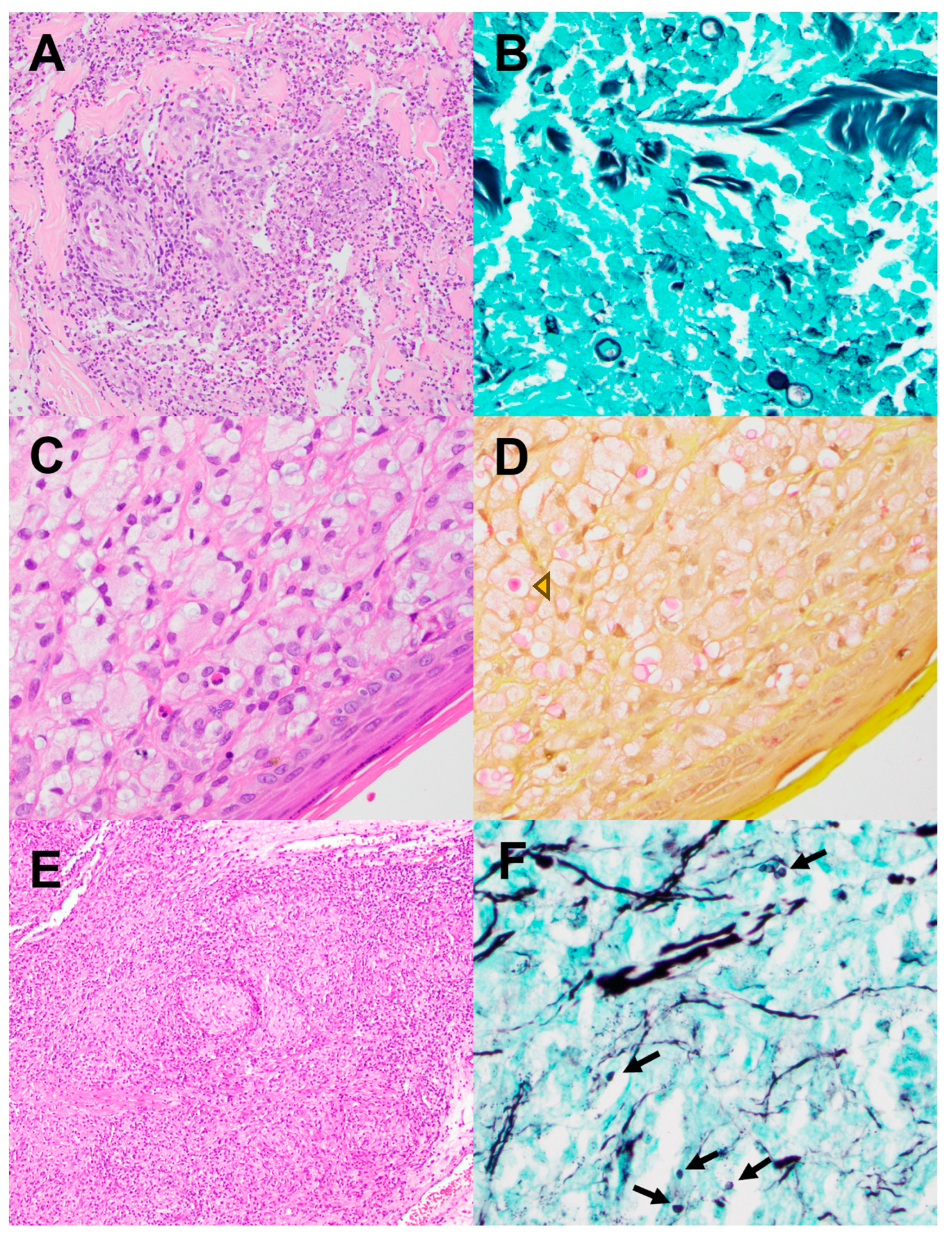 Pathogens 13 00530 g004 Pathogens 13 00530 g004