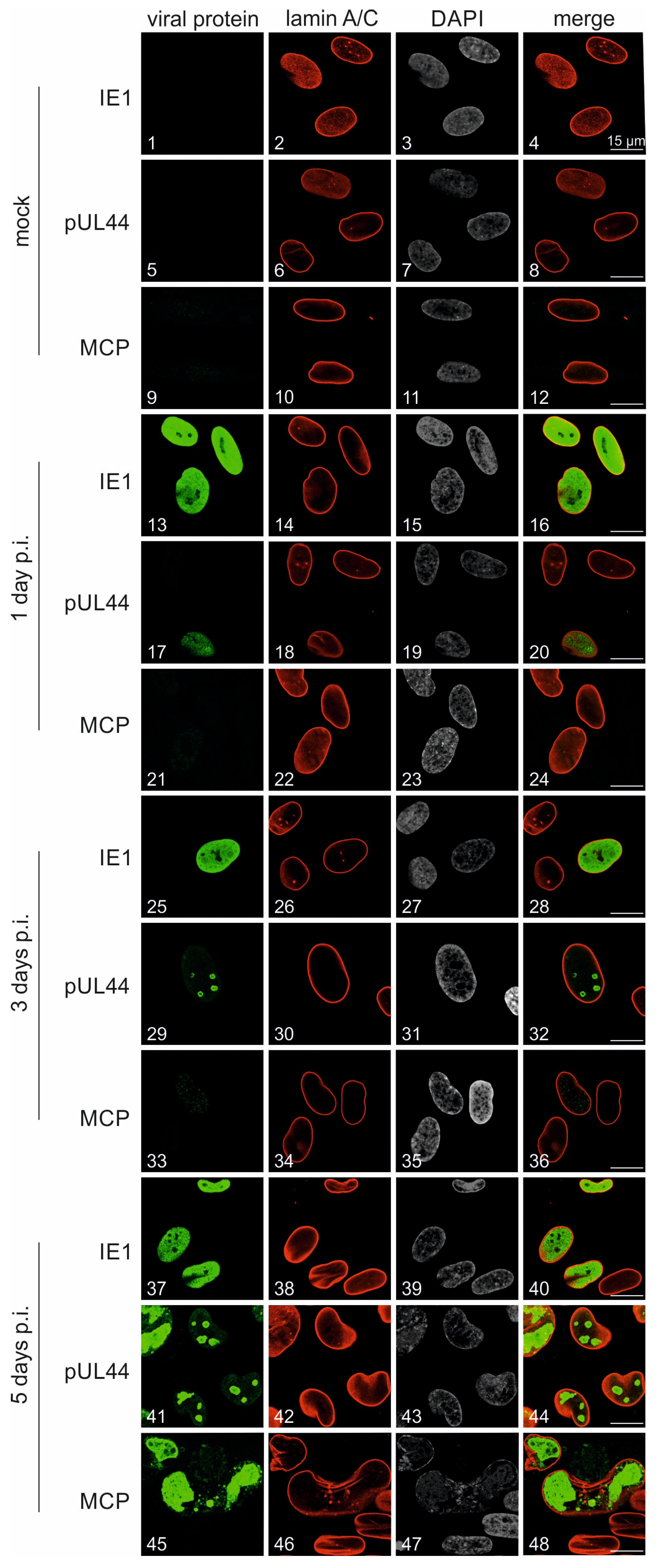 Pathogens 13 00645 g004