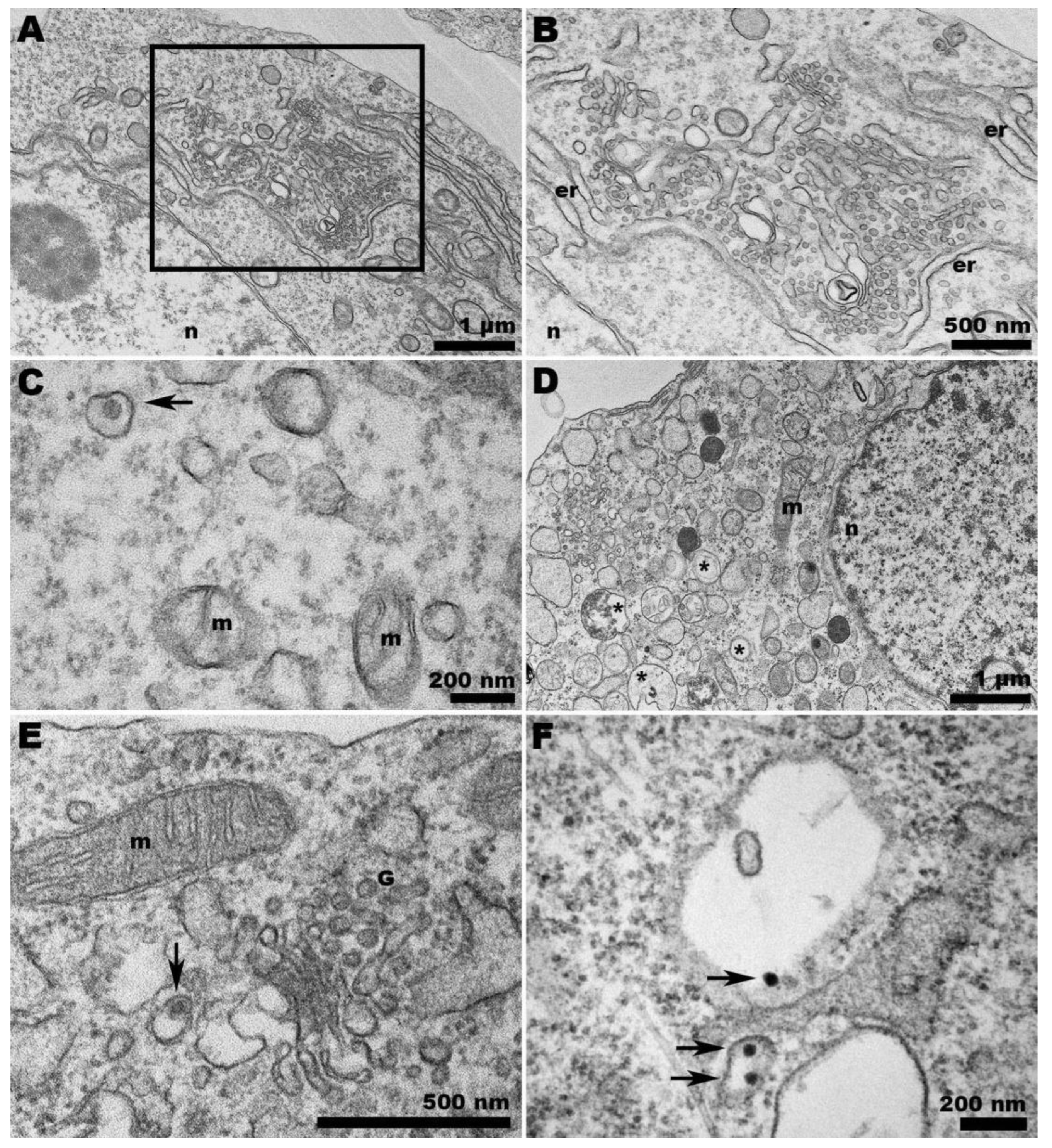 Pathogens 13 00814 g008