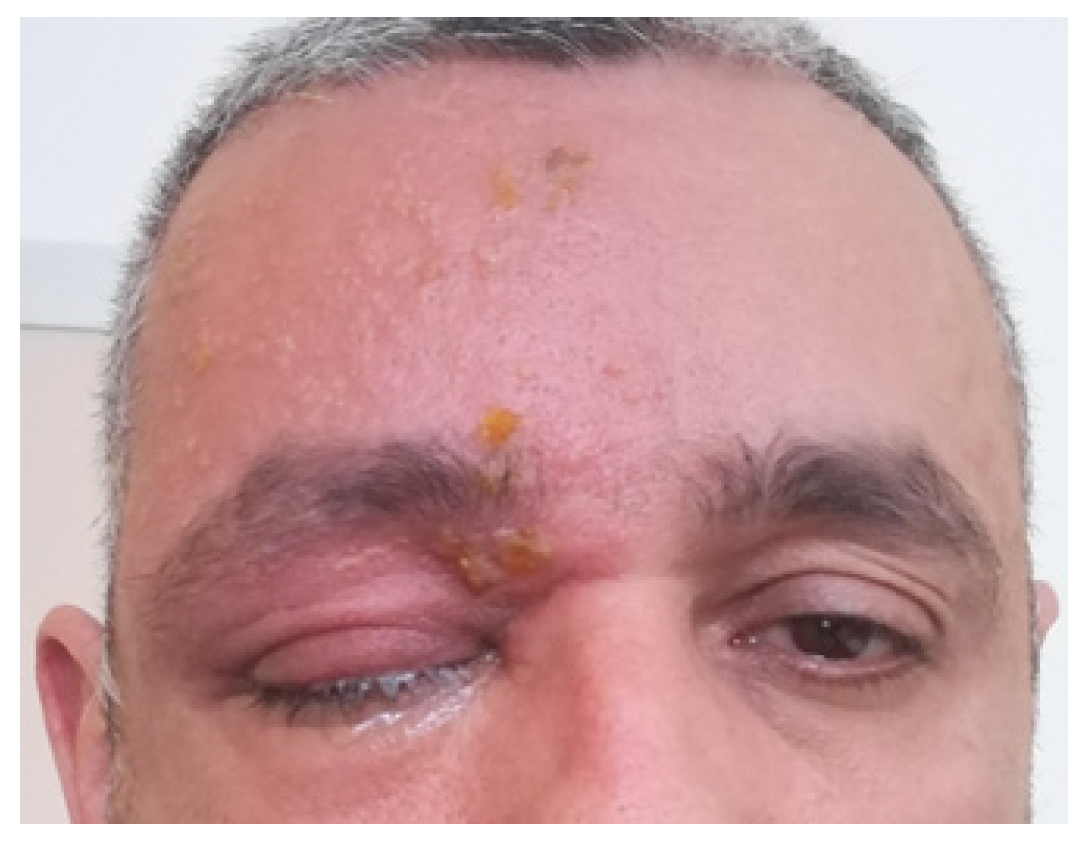 Pathogens 13 00832 g002