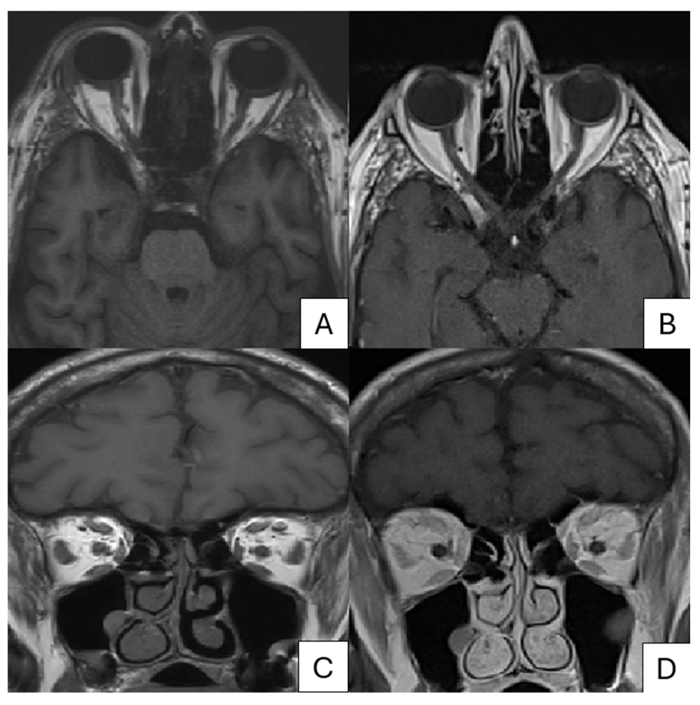 Pathogens 13 00832 g004