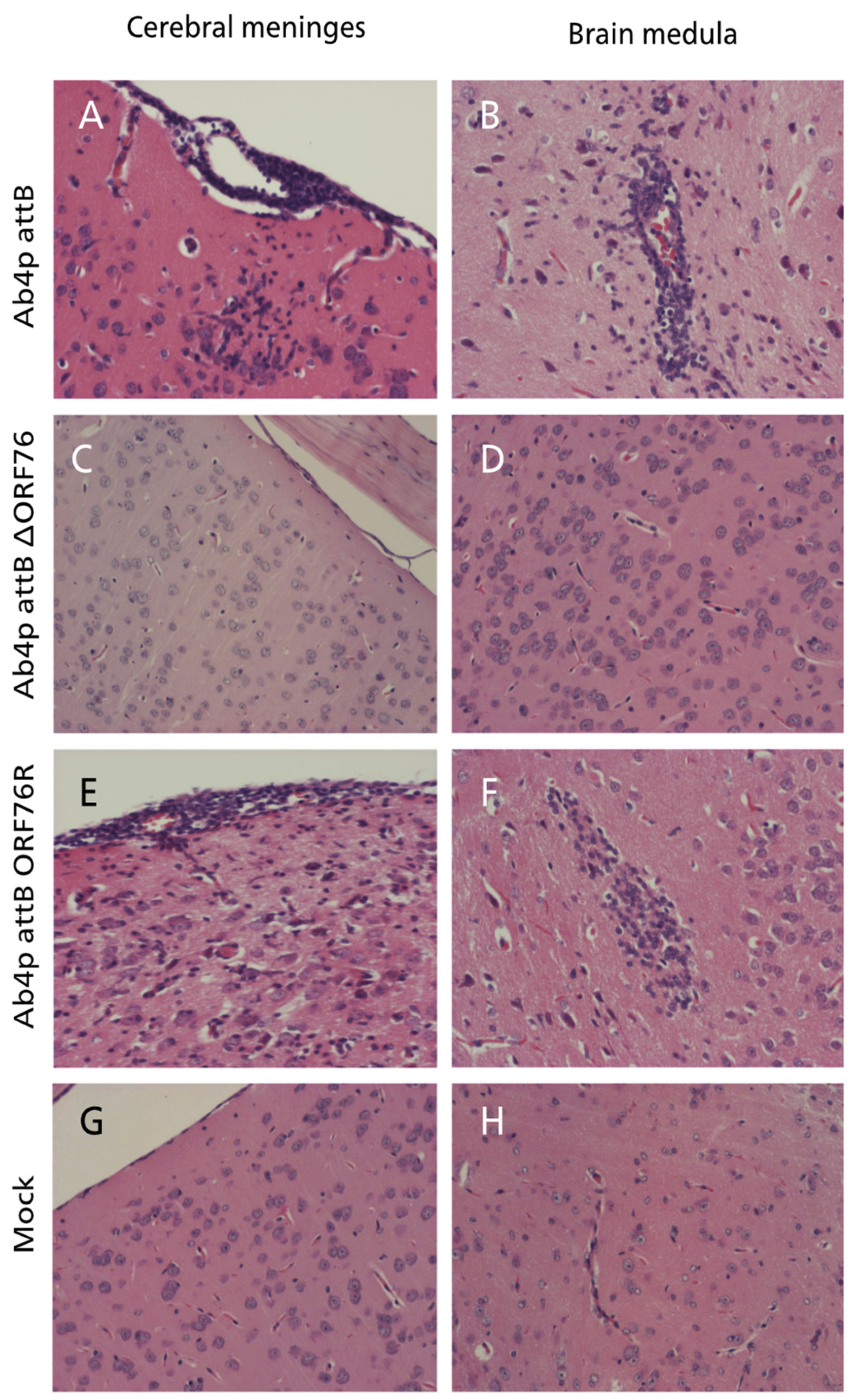 Pathogens 13 00865 g008