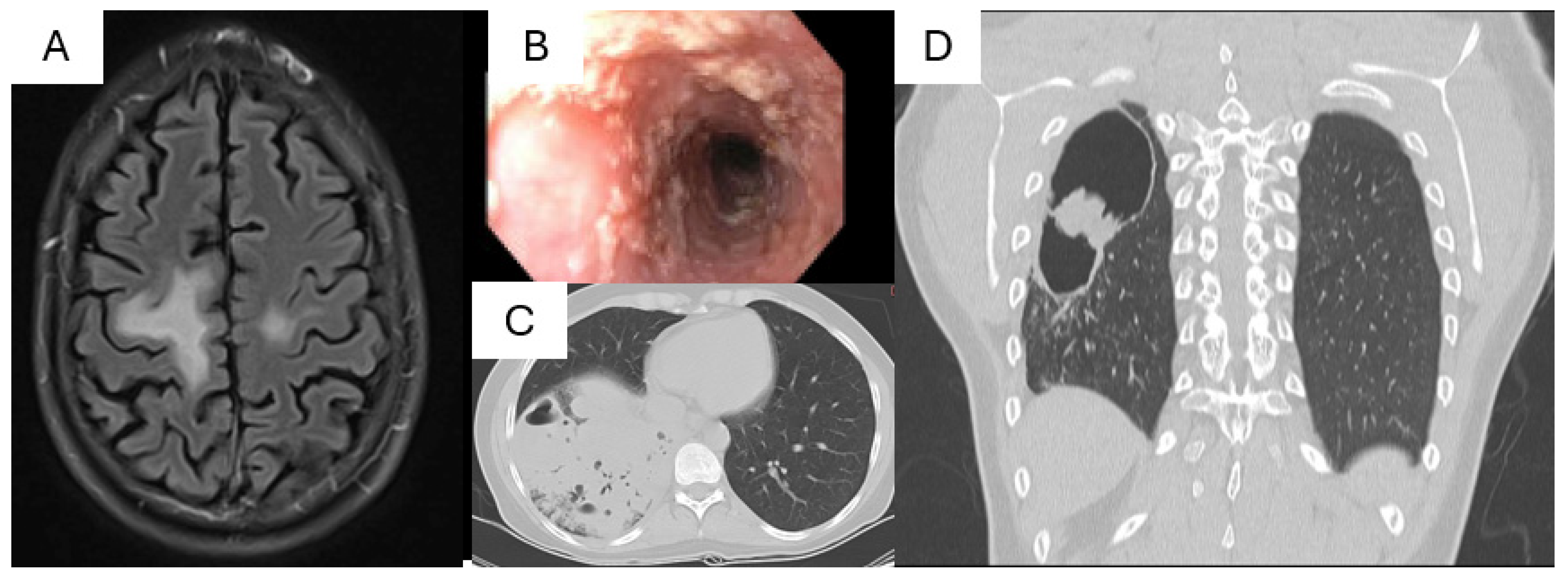Pathogens 13 00955 g002