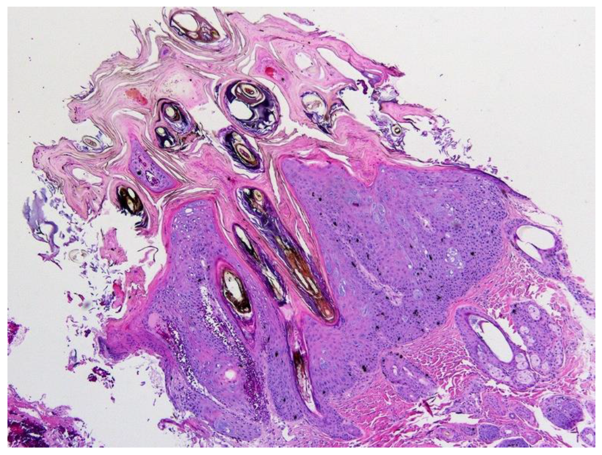 Pathogens 13 01057 g010
