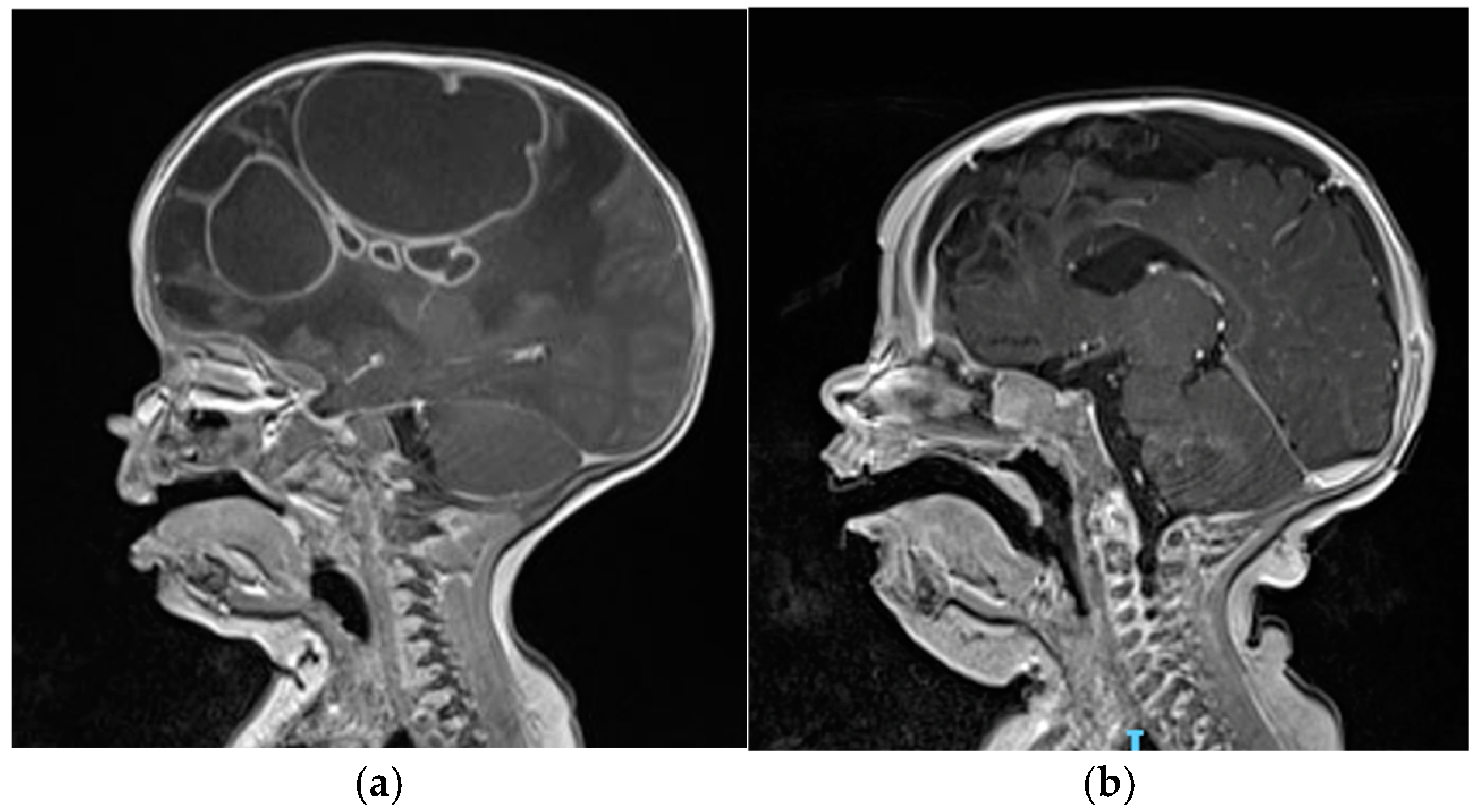 Pathogens 14 00004 g001