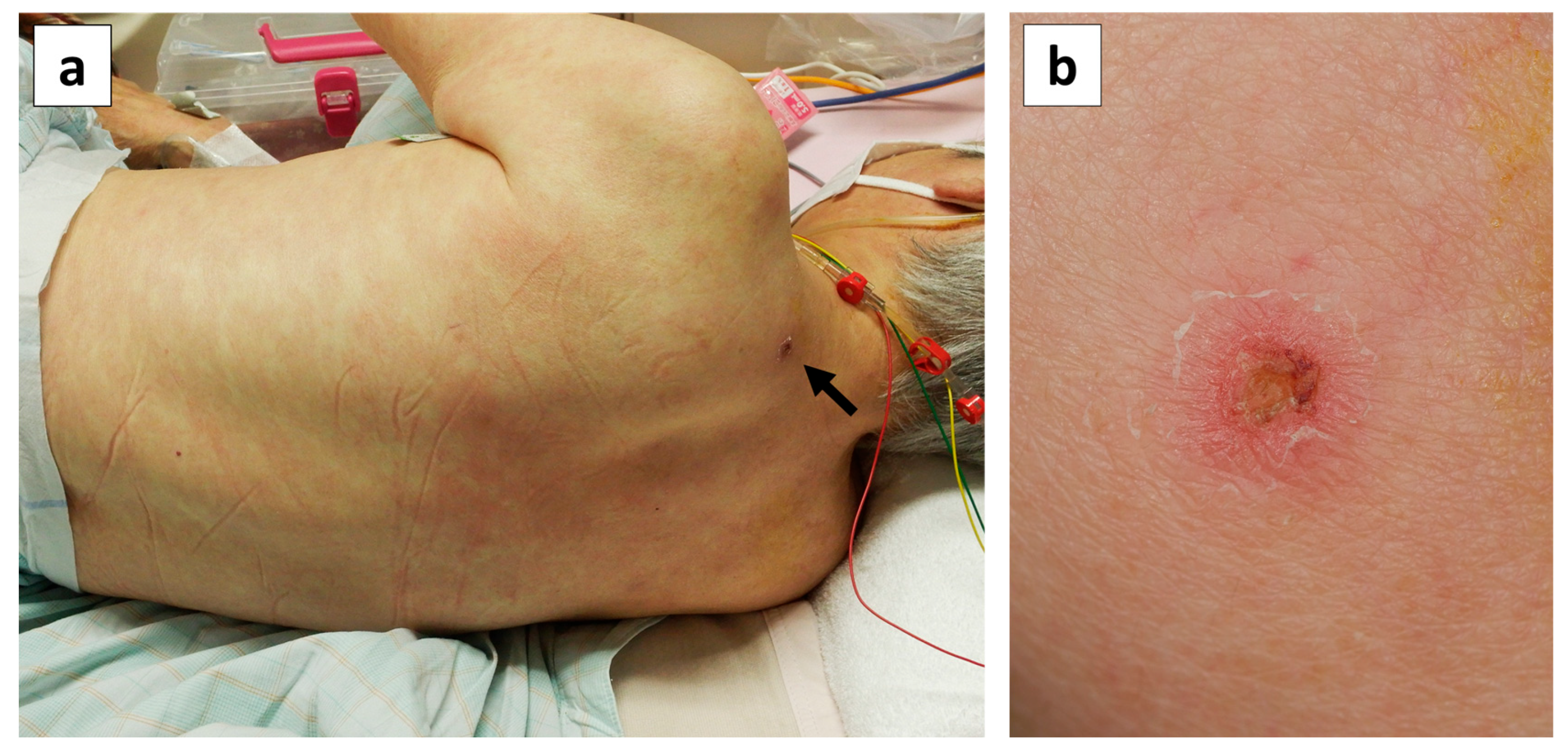 Pathogens 14 00064 g002 Pathogens 14 00064 g002