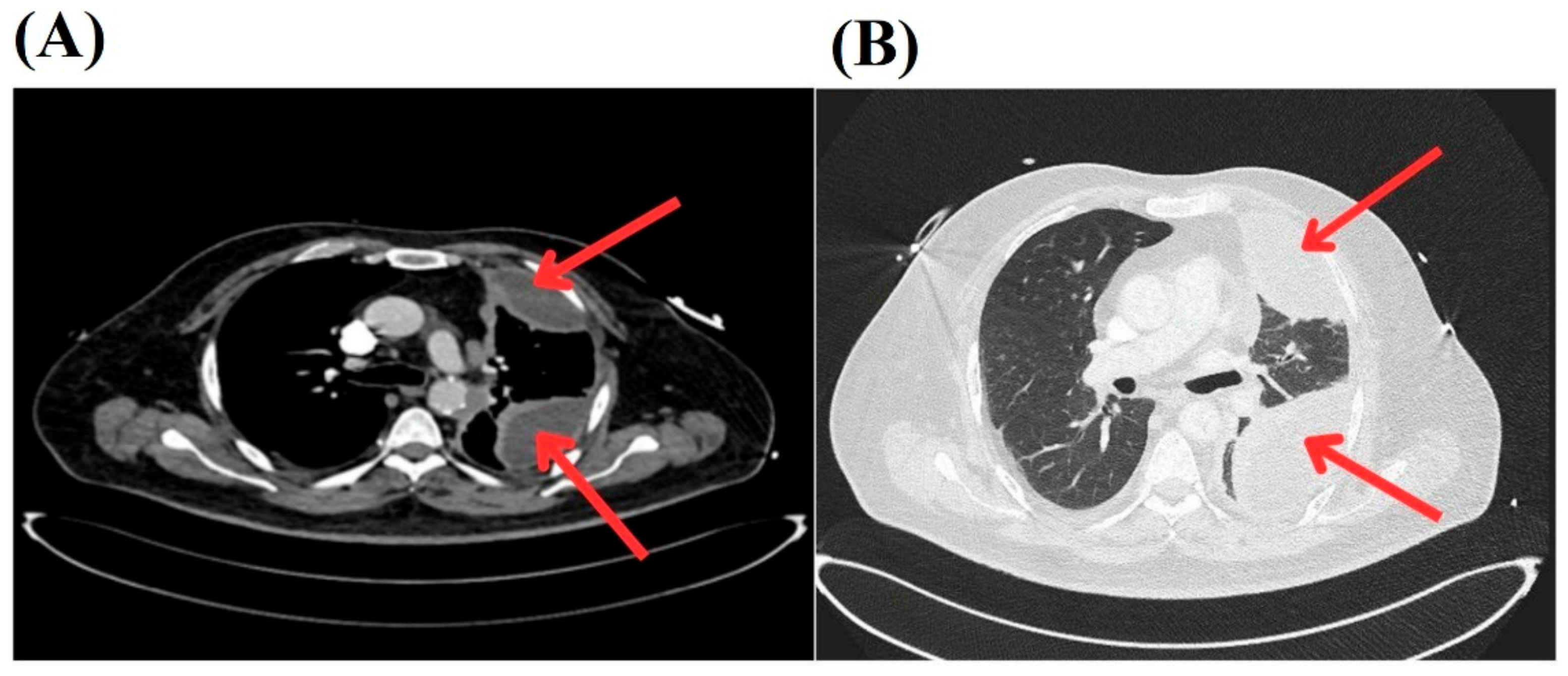 Pathogens 14 00125 g001
