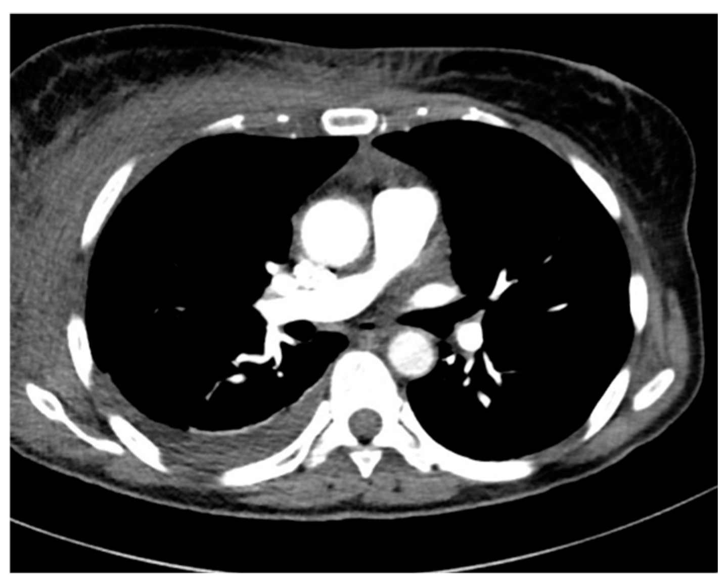 Pathogens 14 00199 g002