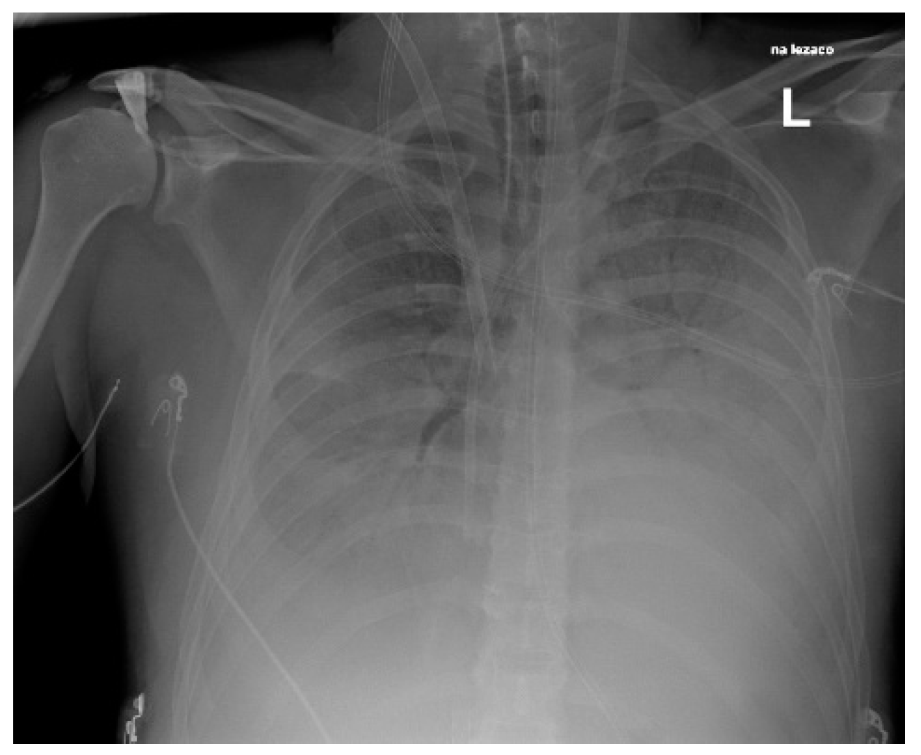 Pathogens 14 00199 g004