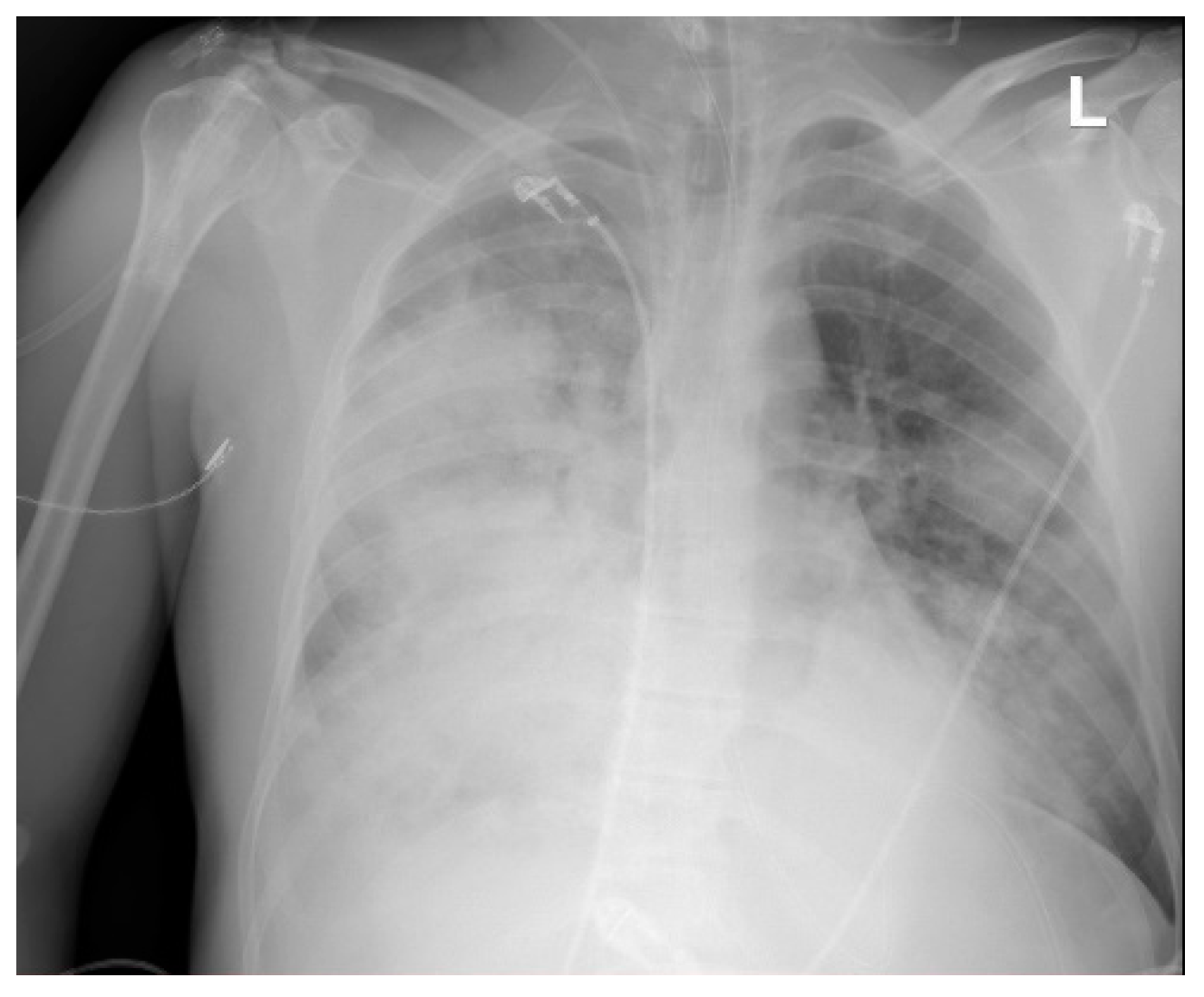 Pathogens 14 00199 g005