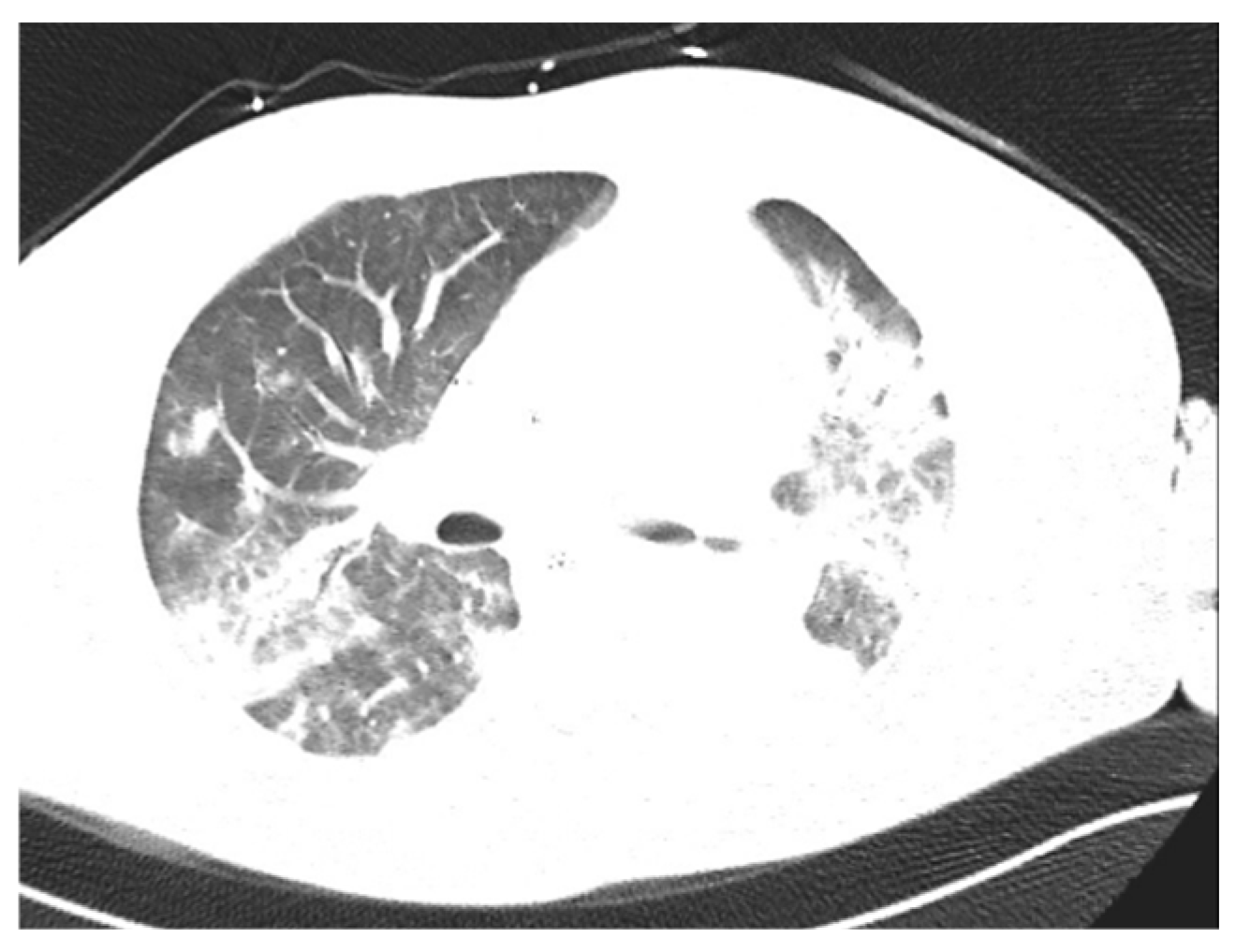 Pathogens 14 00199 g006