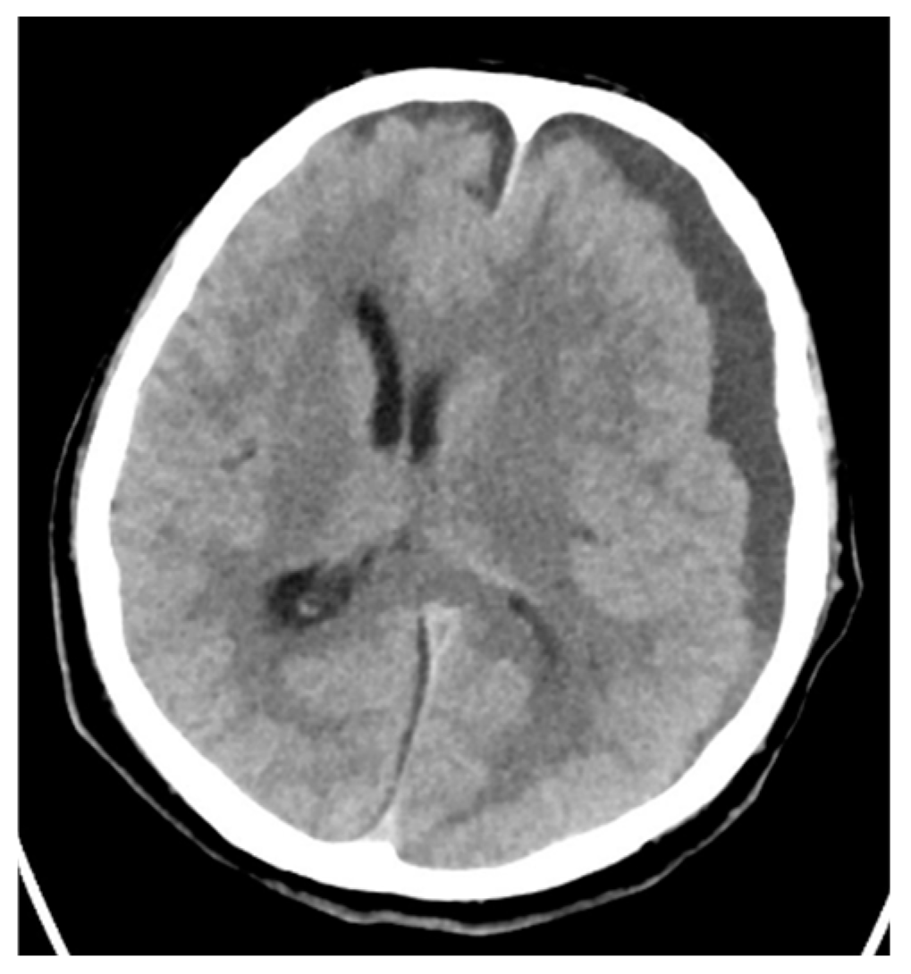 Pathogens 14 00199 g007