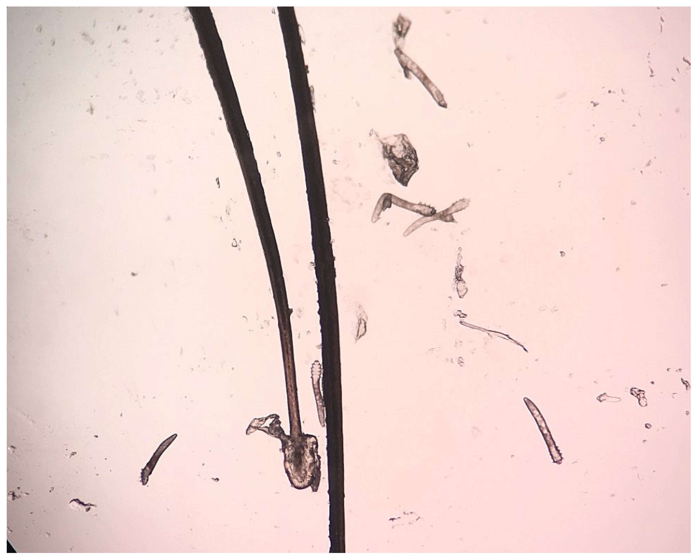 Pathogens 14 00297 g001