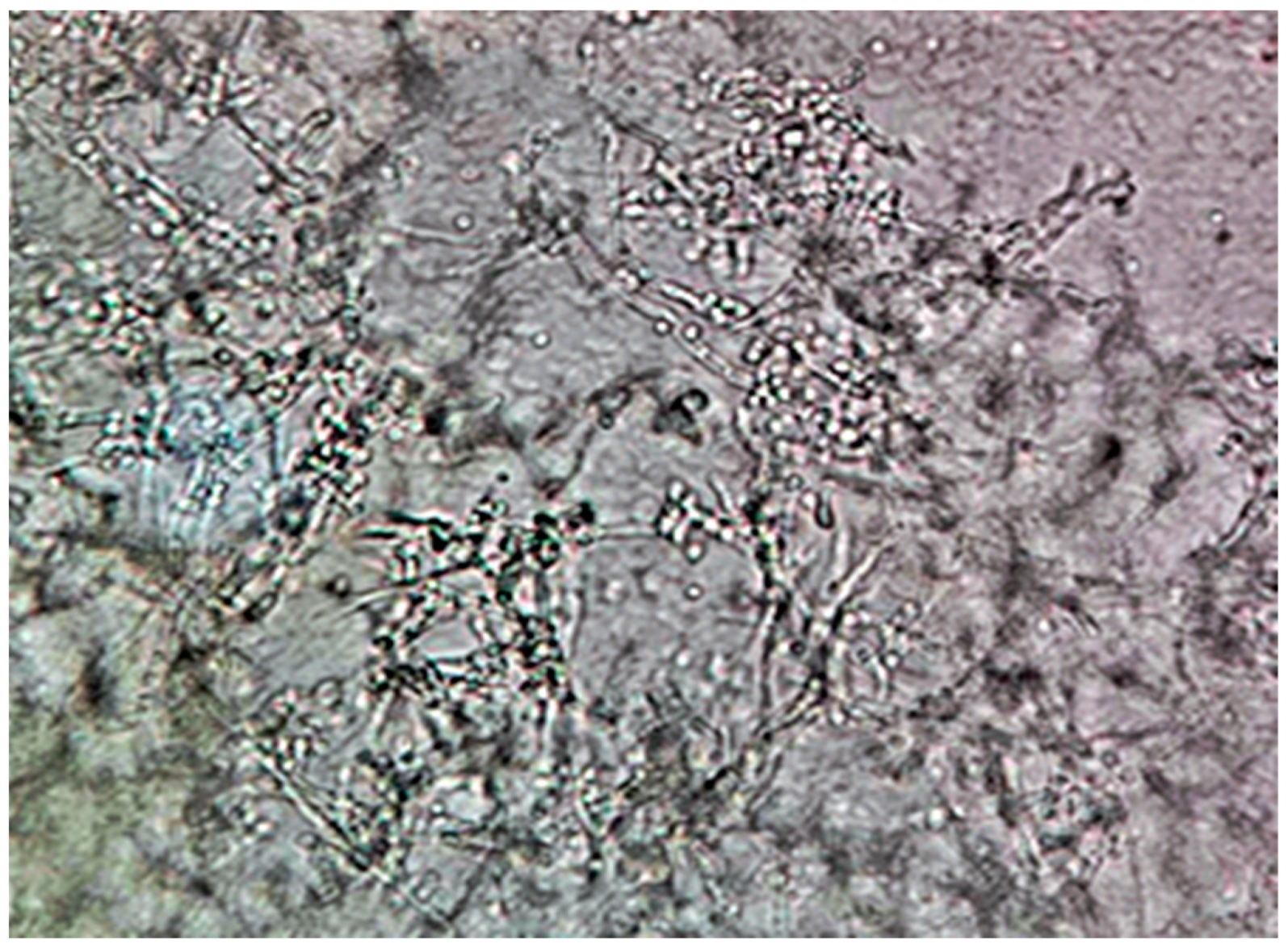 Pathogens 14 00327 g005