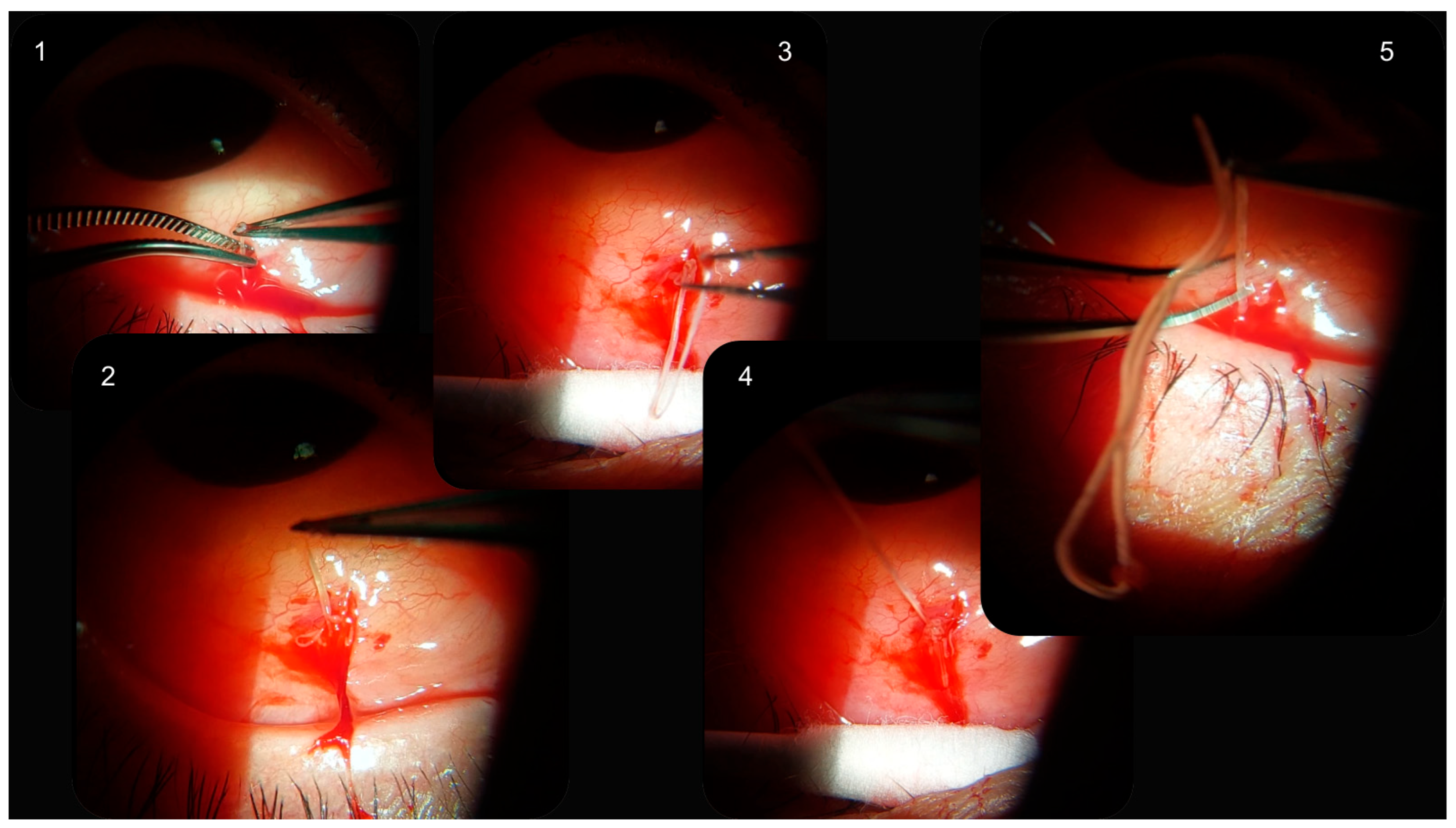 Pathogens 14 00423 g002