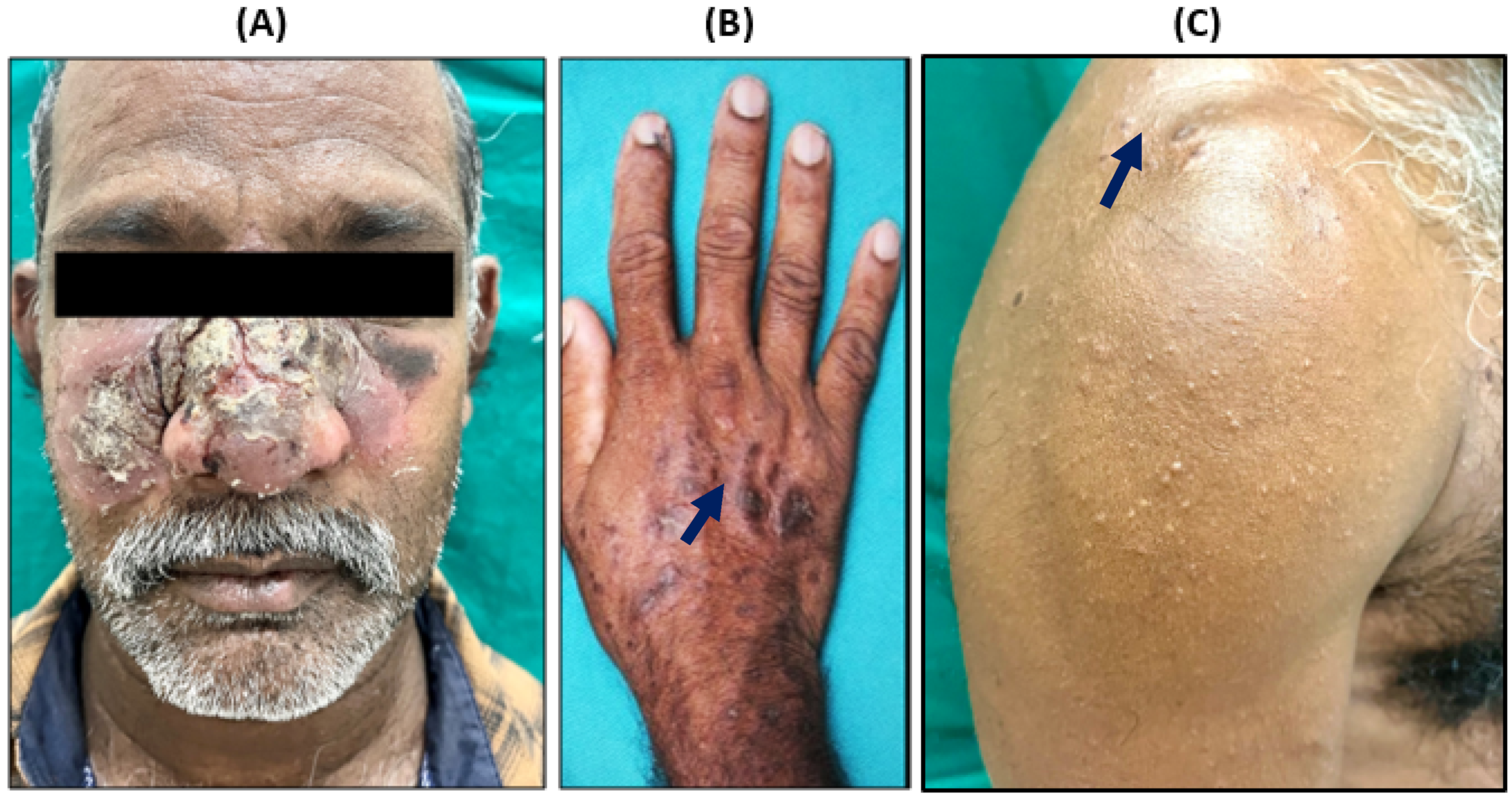 Pathogens 14 00436 g001