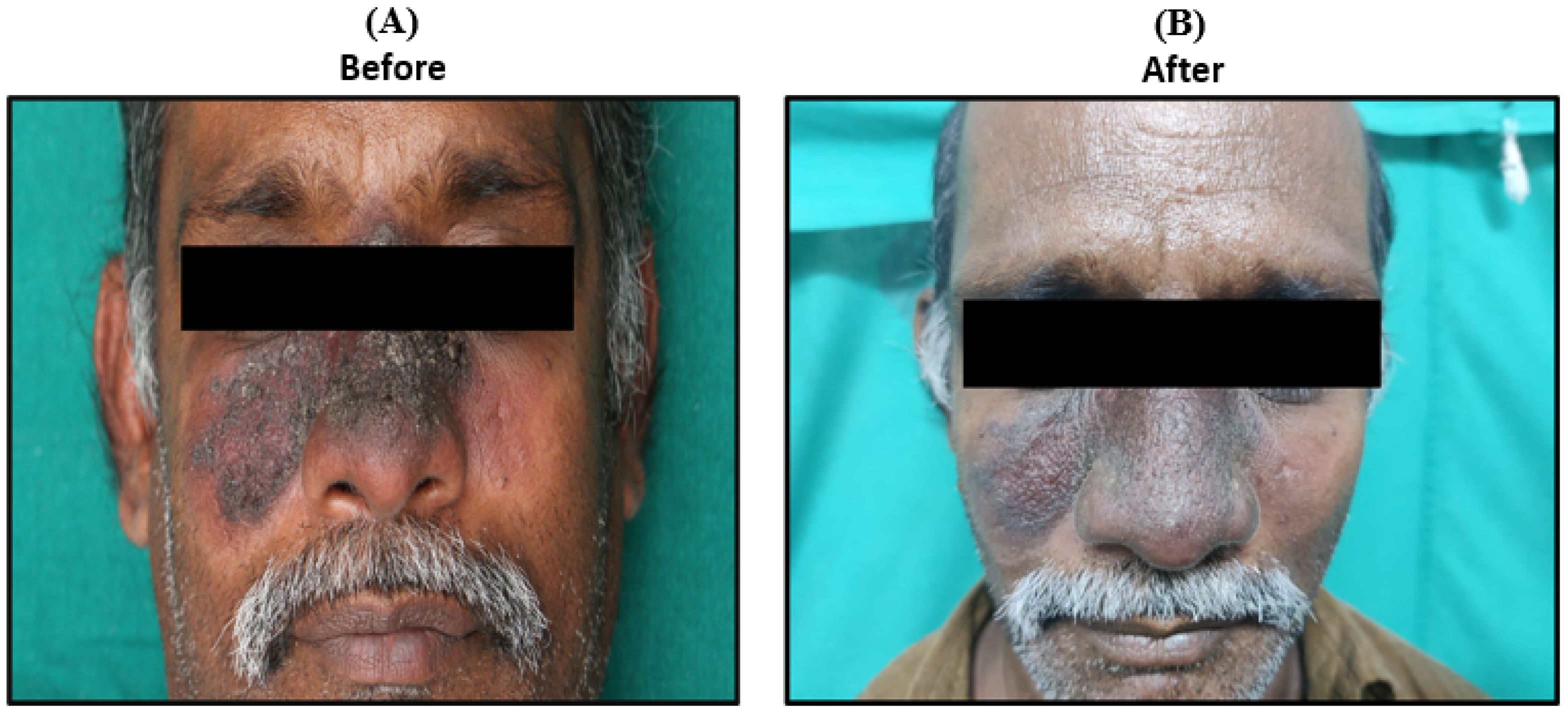 Pathogens 14 00436 g005