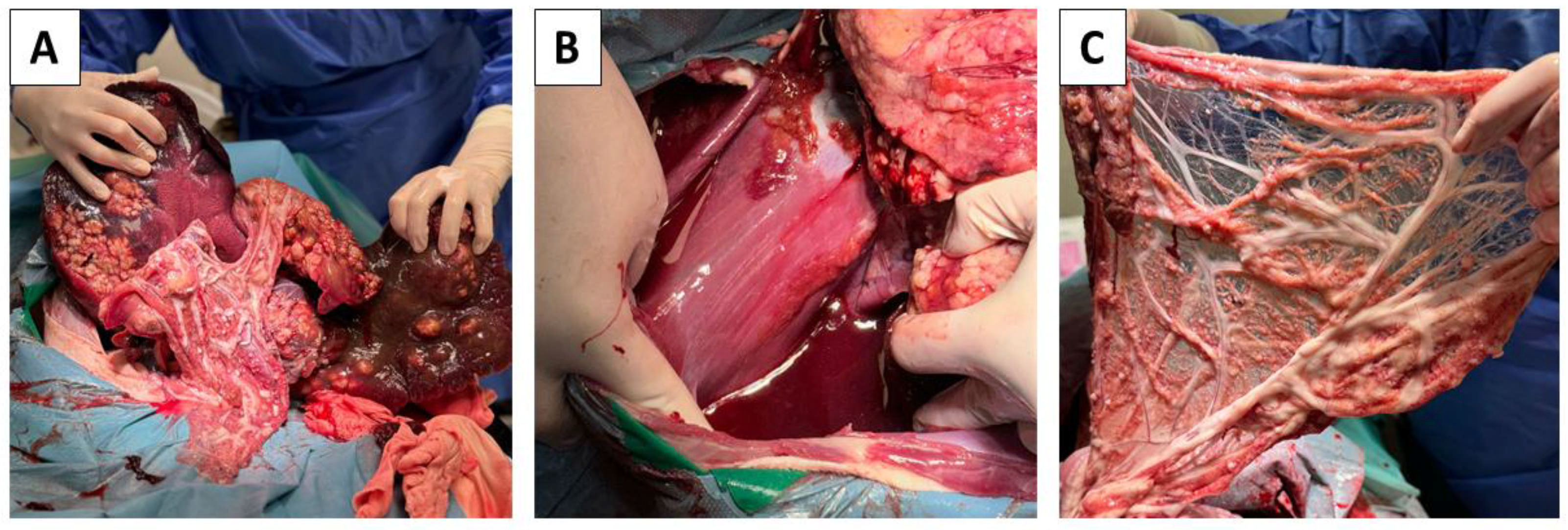 Pathogens 14 00450 g003