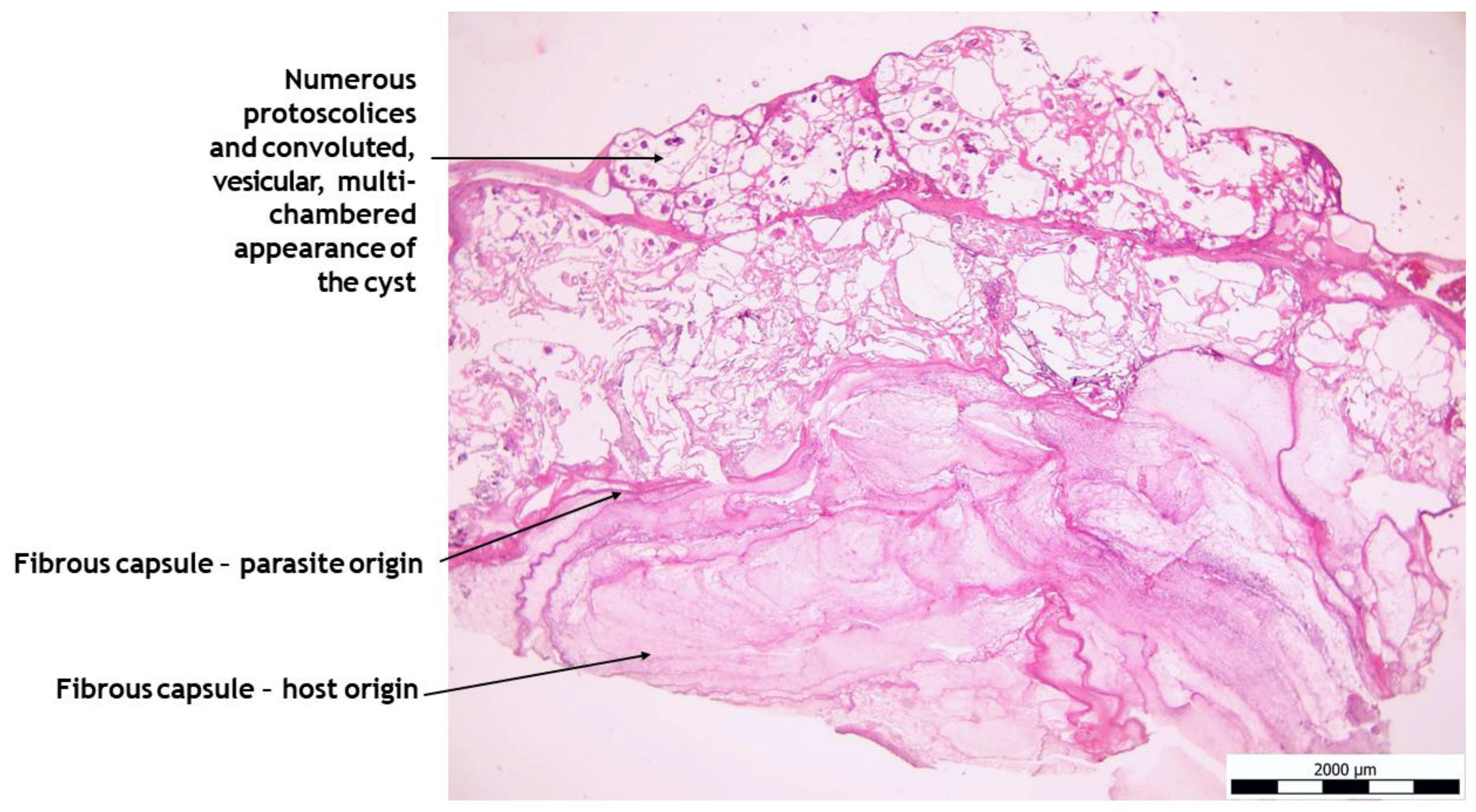 Pathogens 14 00450 g005