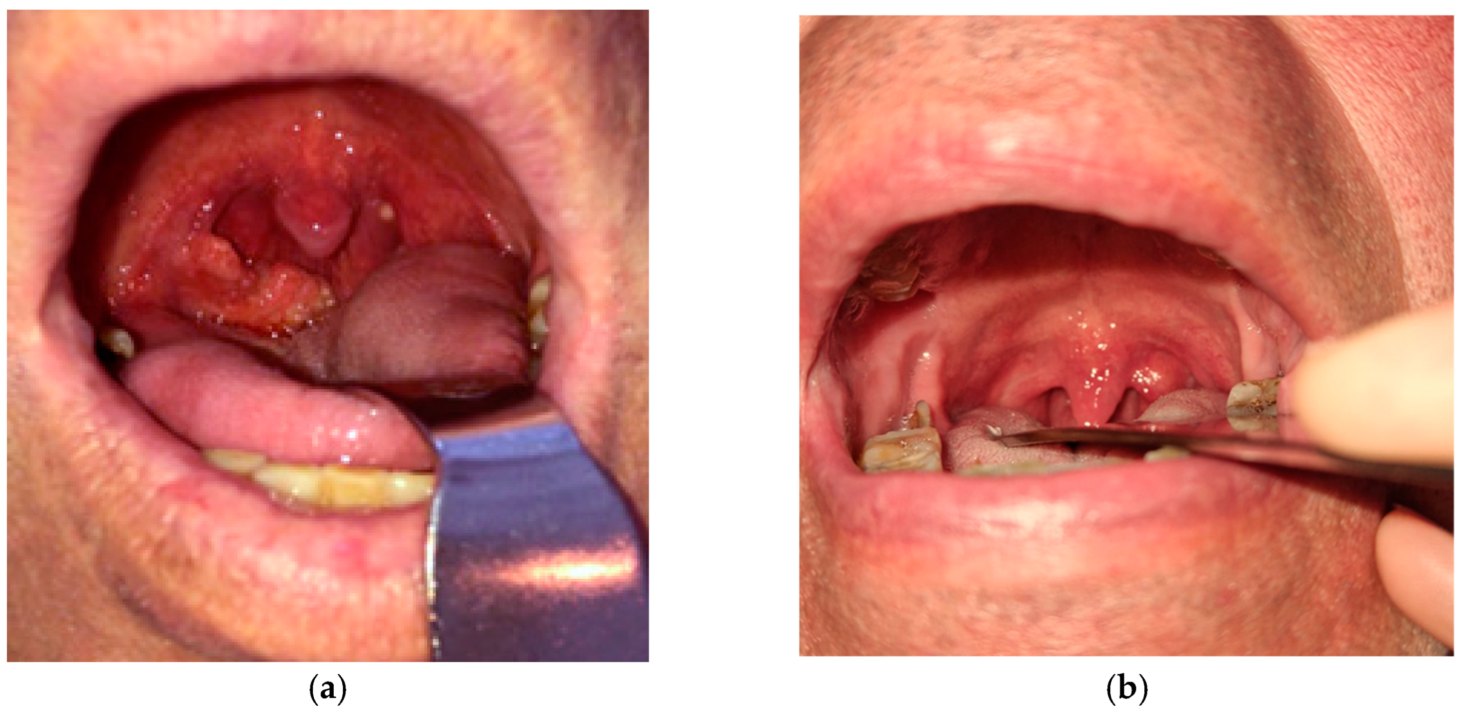 Pathogens 14 00479 g001